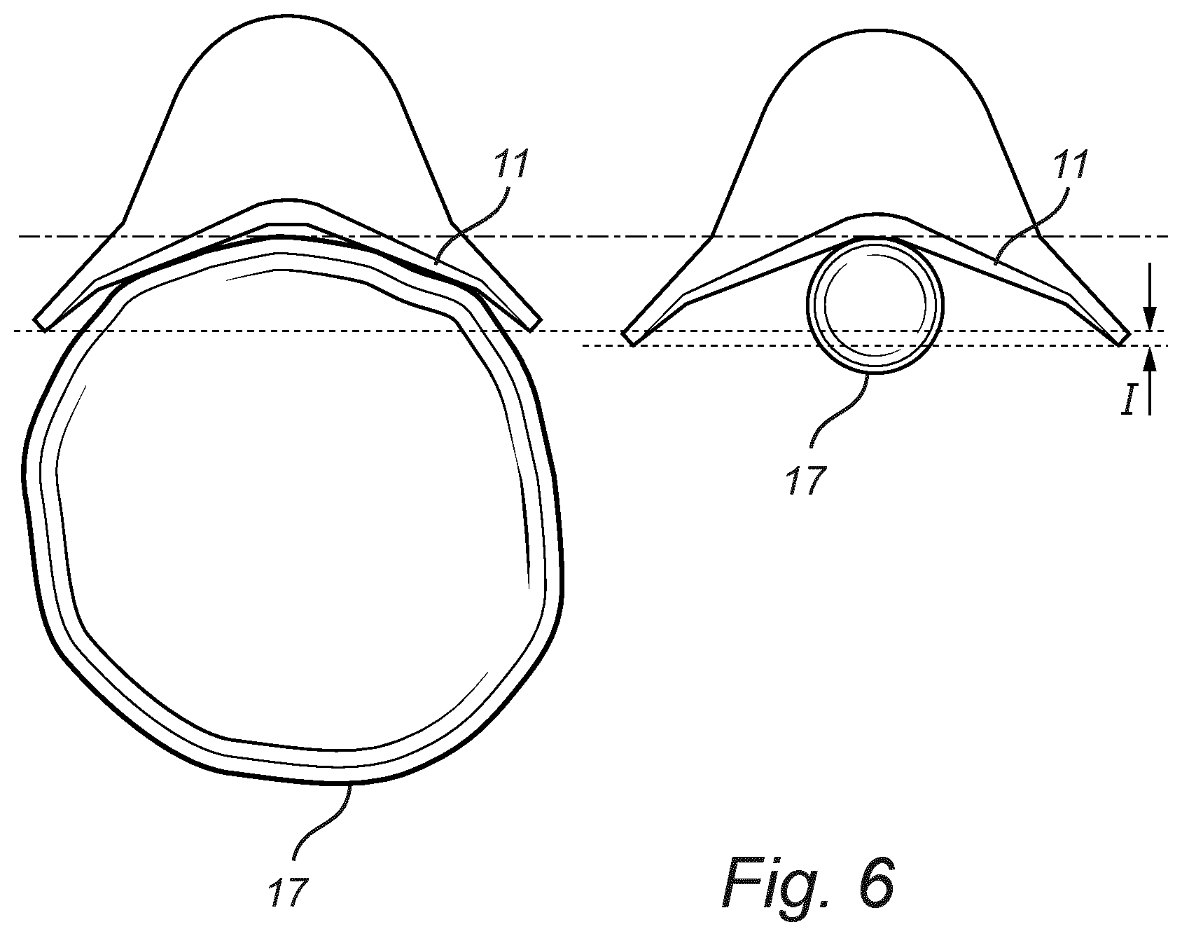 Patent US12317787 Figure 6 – Harvesting head for forestry and a method for determining a thickness of a tree trunk in a harvesting head for forestry