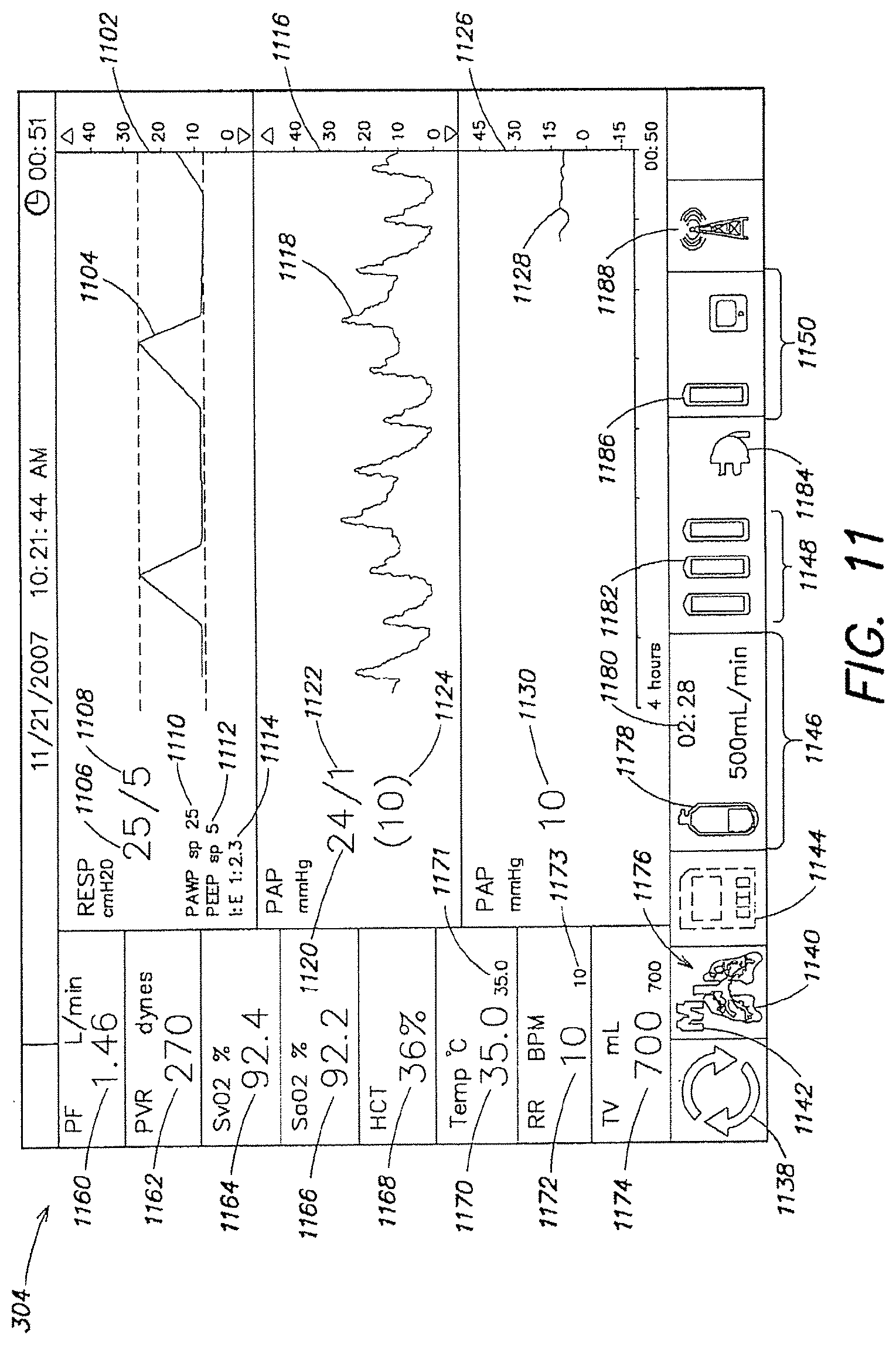 Patent US12317888 Figure 12 – Systems and methods for ex vivo lung care