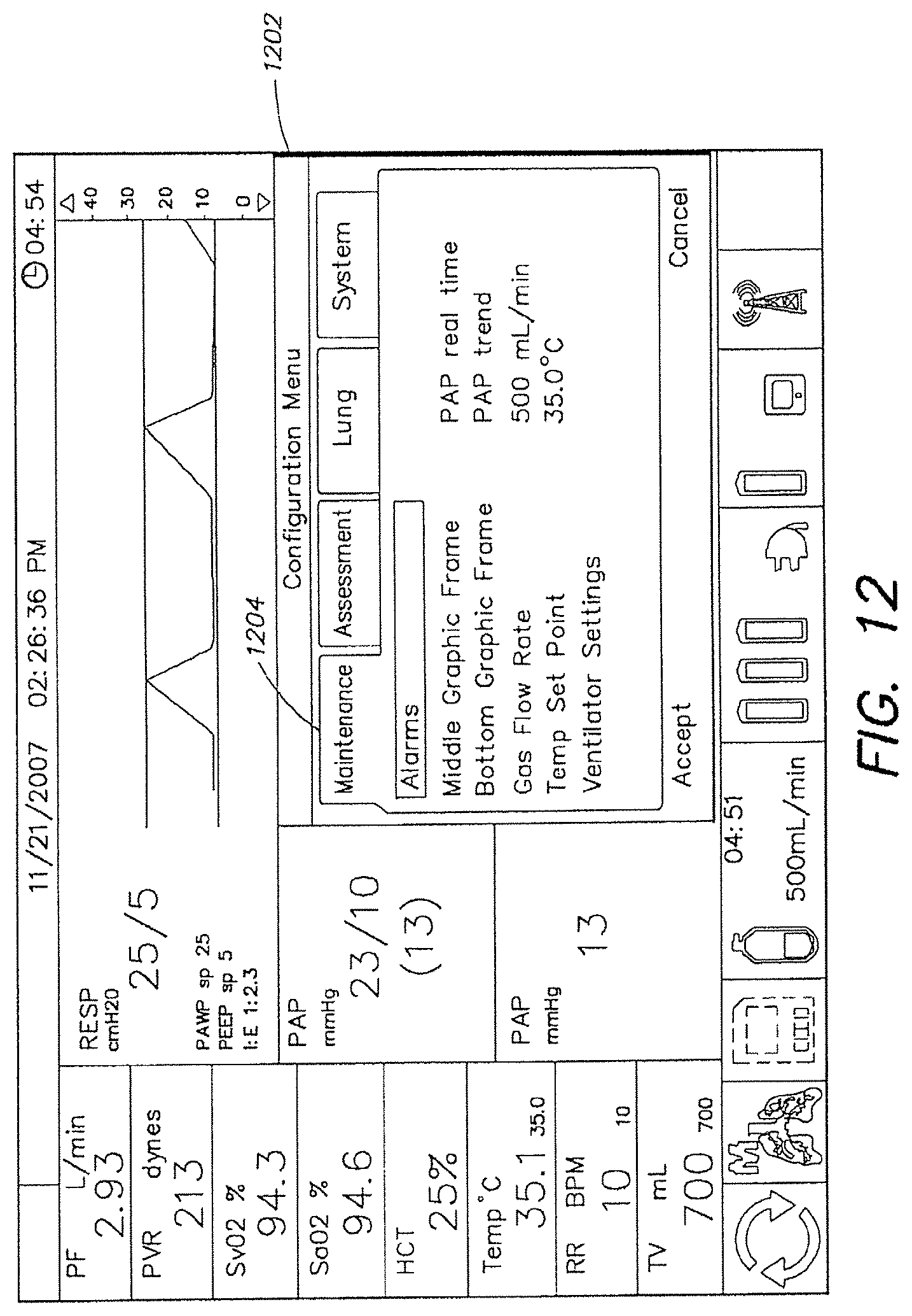 Patent US12317888 Figure 13 – Systems and methods for ex vivo lung care