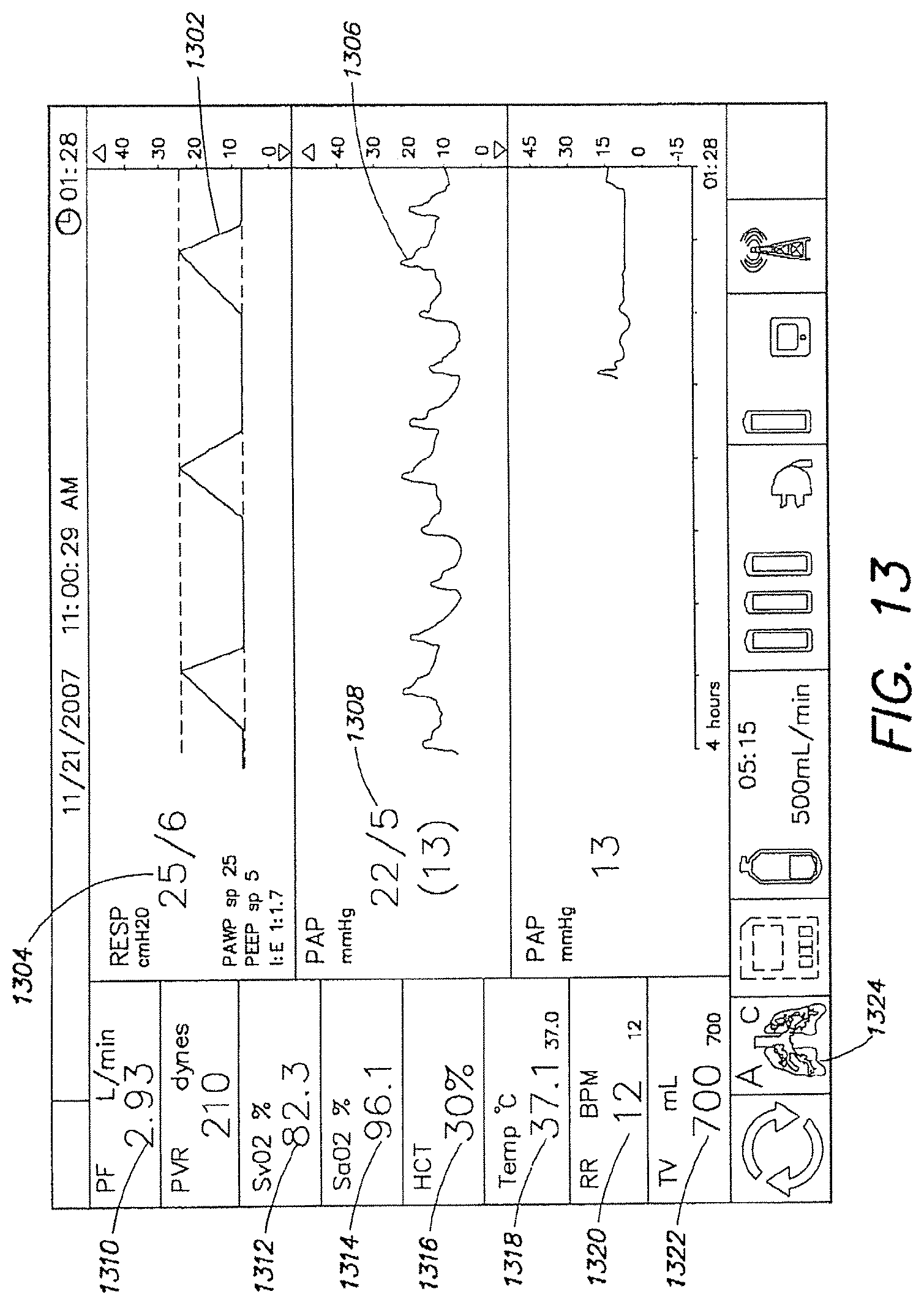 Patent US12317888 Figure 14 – Systems and methods for ex vivo lung care