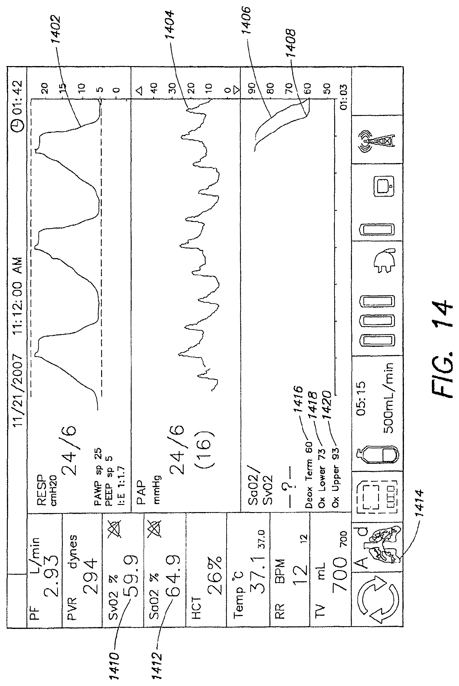 Patent US12317888 Figure 15 – Systems and methods for ex vivo lung care