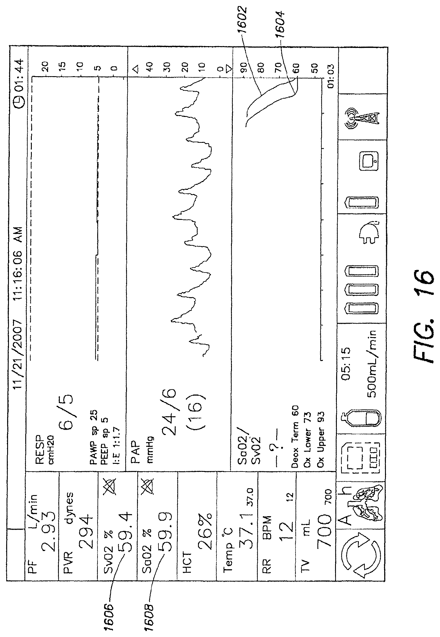 Patent US12317888 Figure 17 – Systems and methods for ex vivo lung care