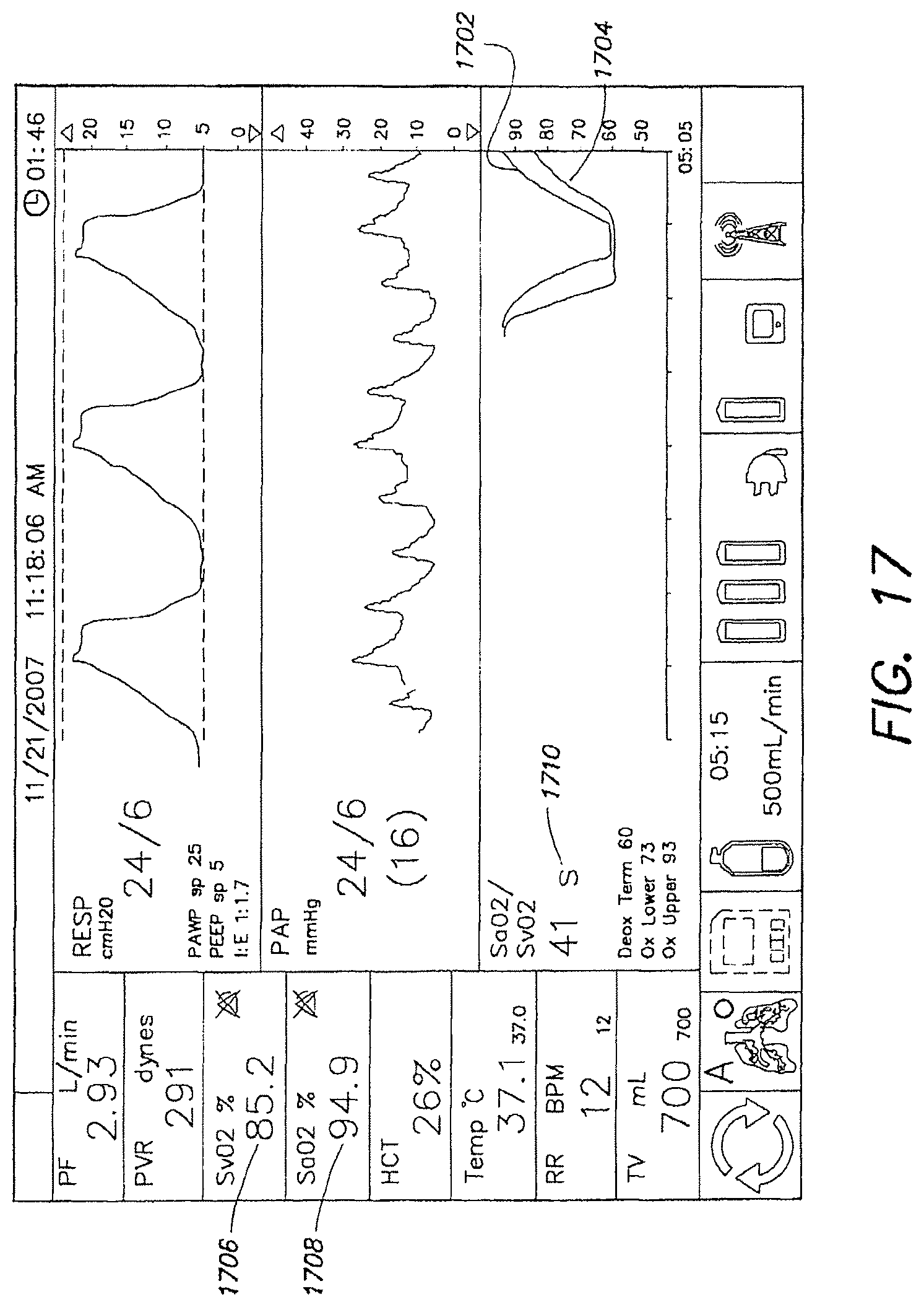 Patent US12317888 Figure 18 – Systems and methods for ex vivo lung care