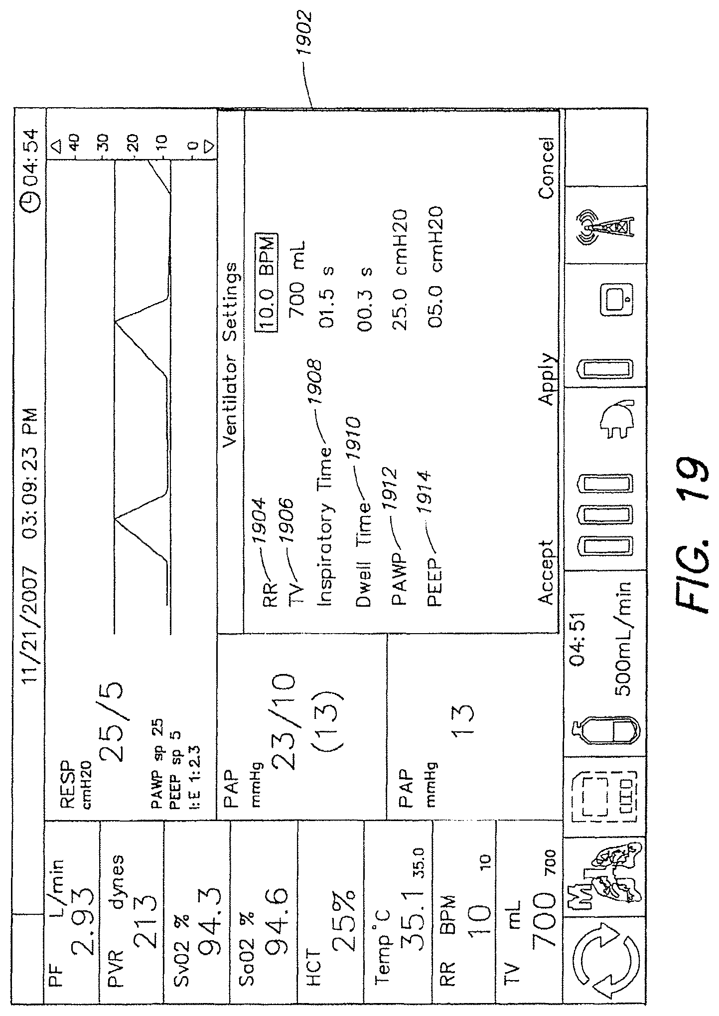 Patent US12317888 Figure 20 – Systems and methods for ex vivo lung care