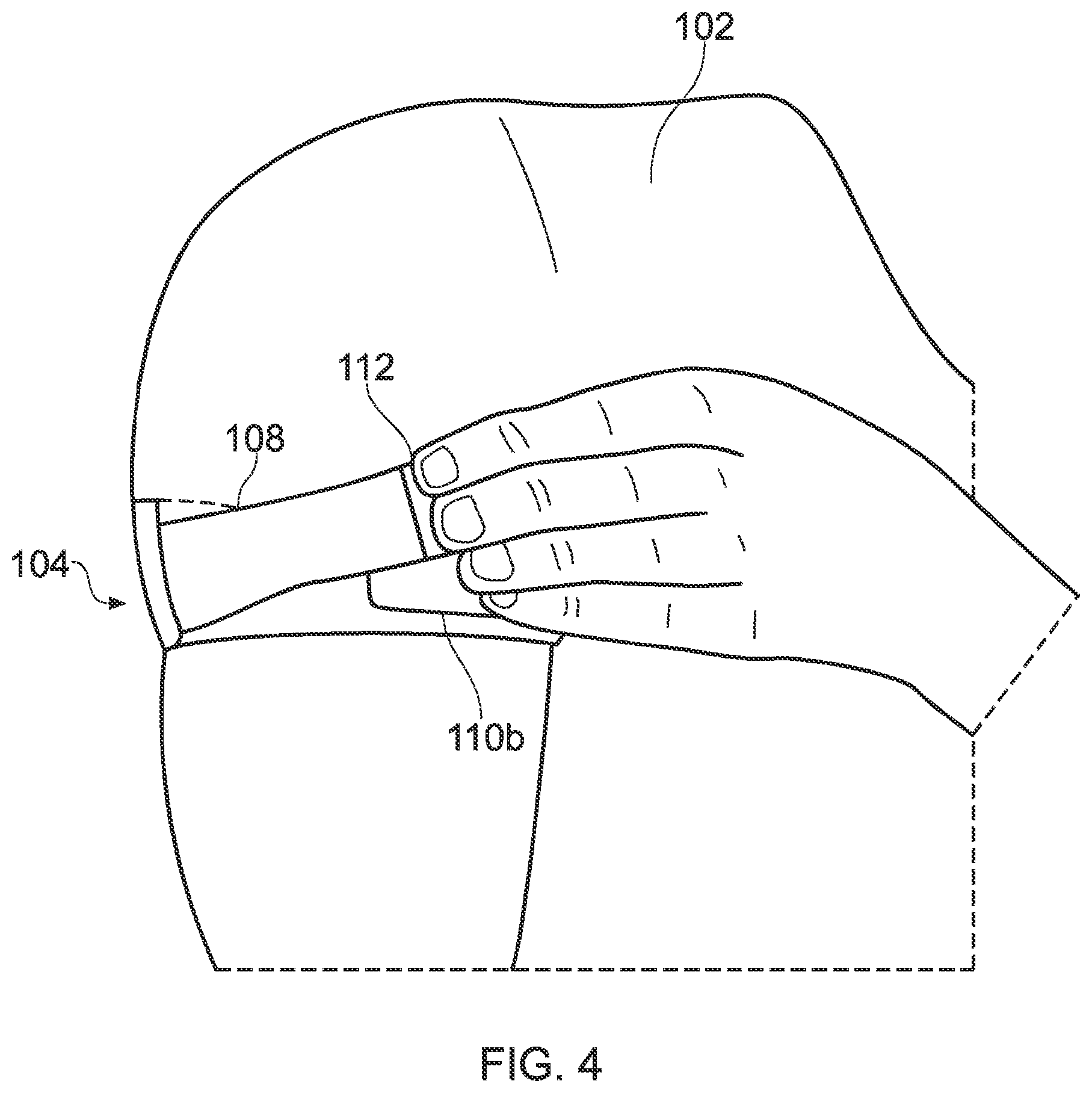 Patent US12317940 Figure 4 – Blood flow restriction sportswear garment