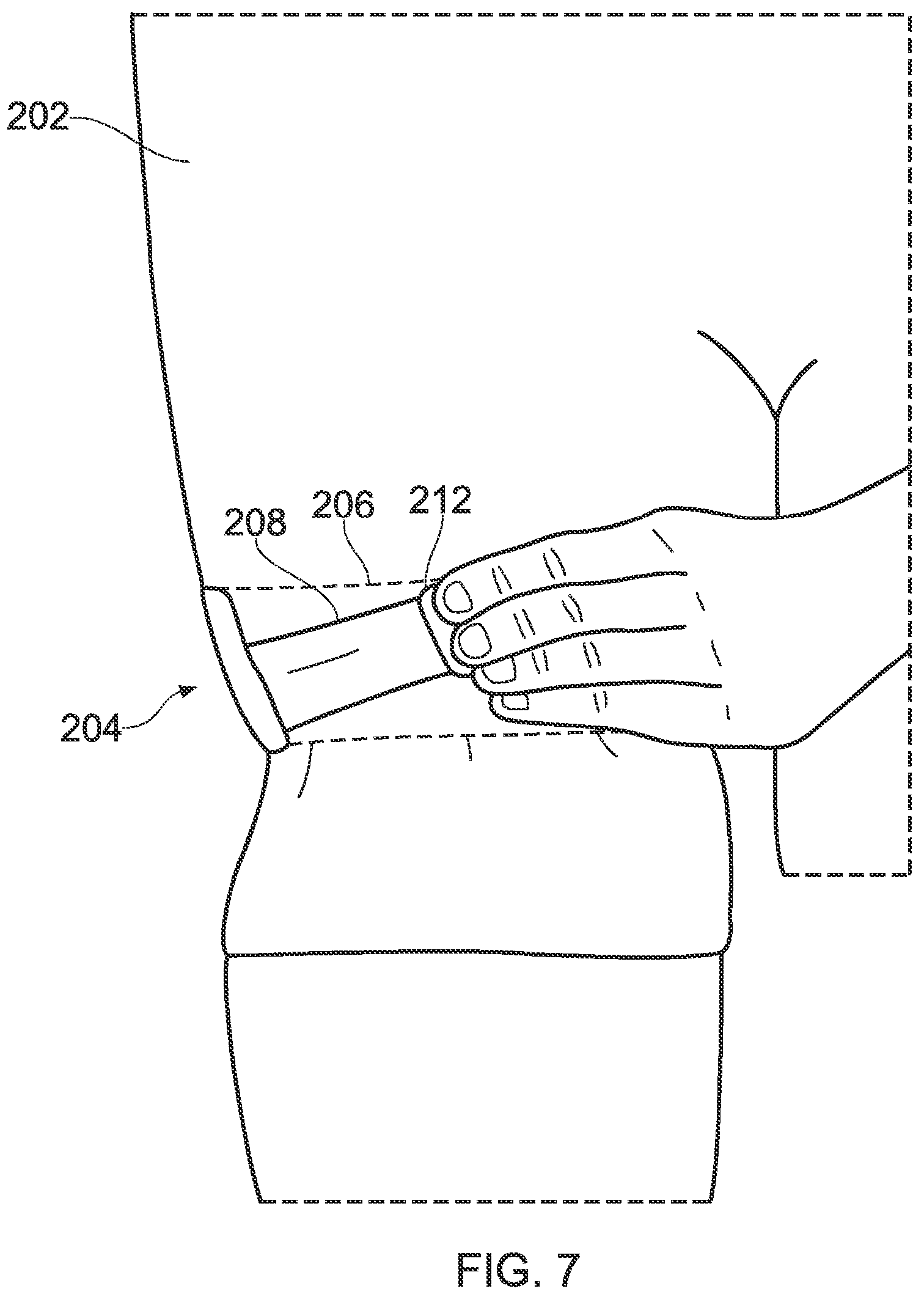 Patent US12317940 Figure 7 – Blood flow restriction sportswear garment