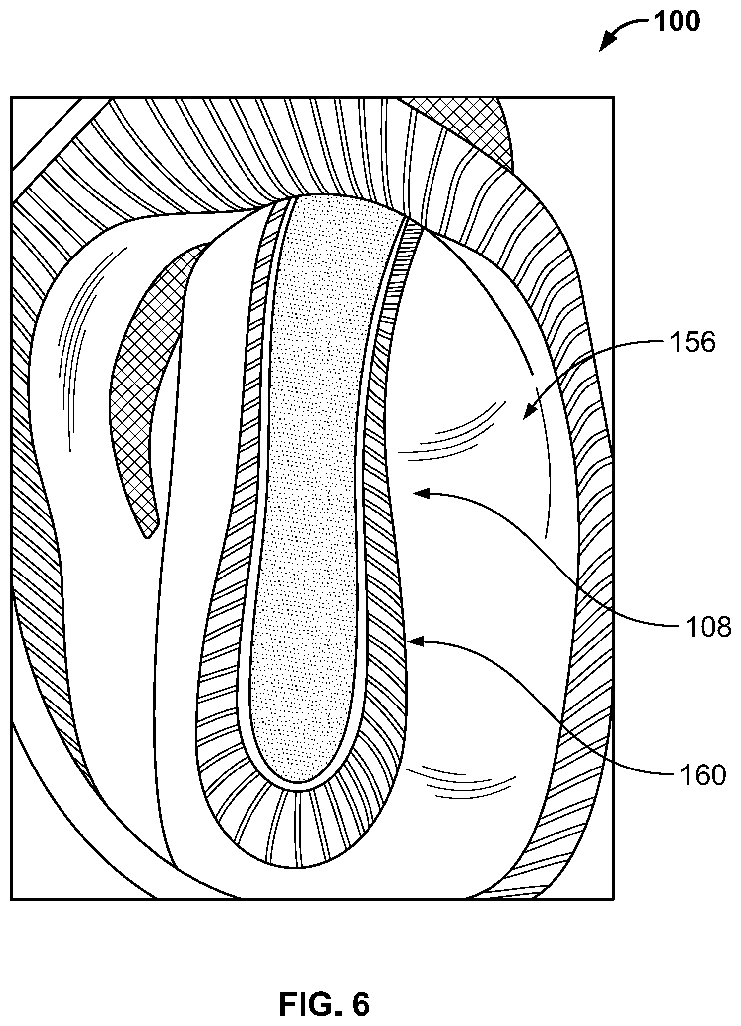 Patent US12317949 Figure 6 – Article of footwear