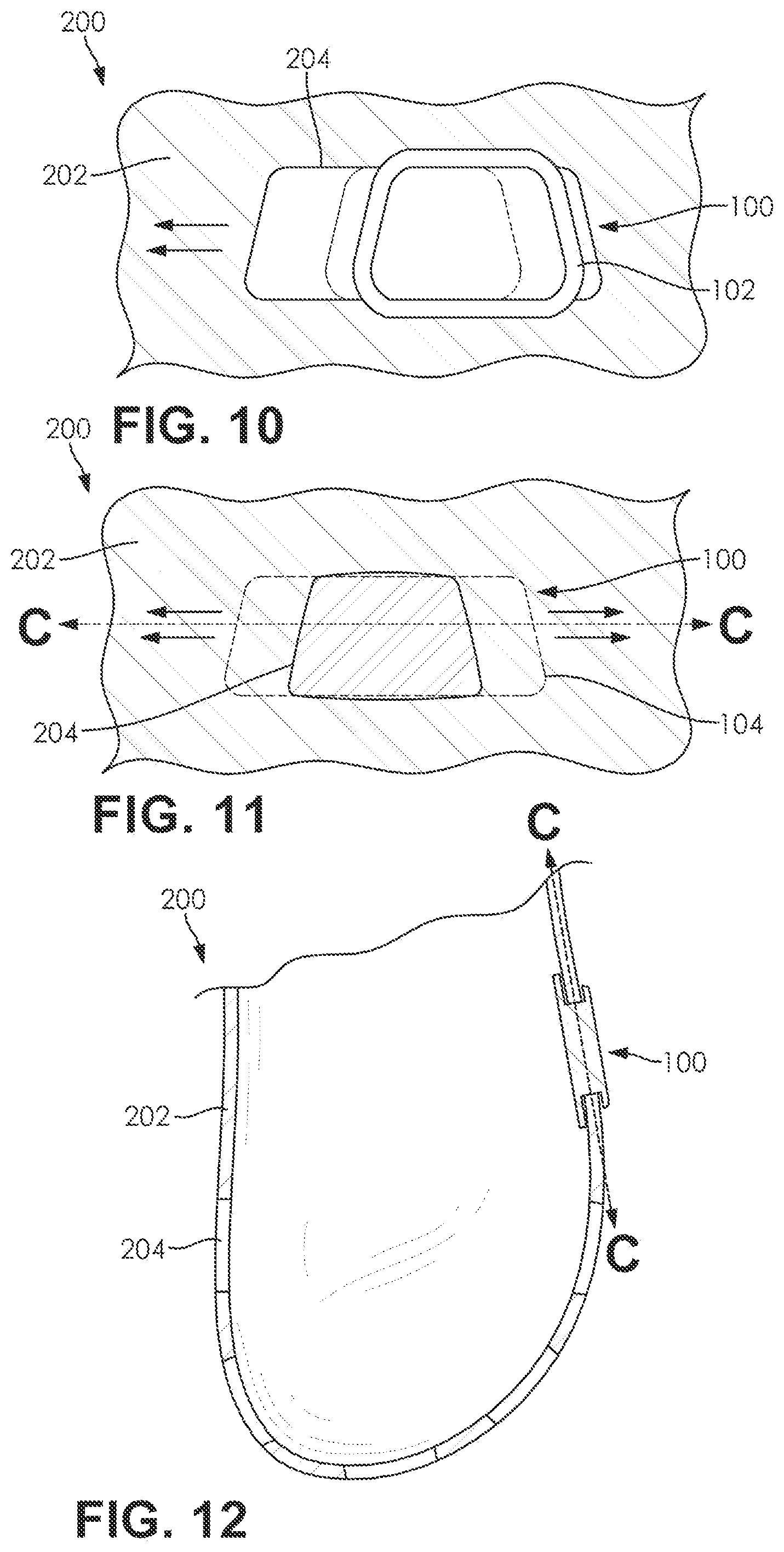Patent US12317958 Figure 4 – Shoe accessory and related system, kit, and method of use