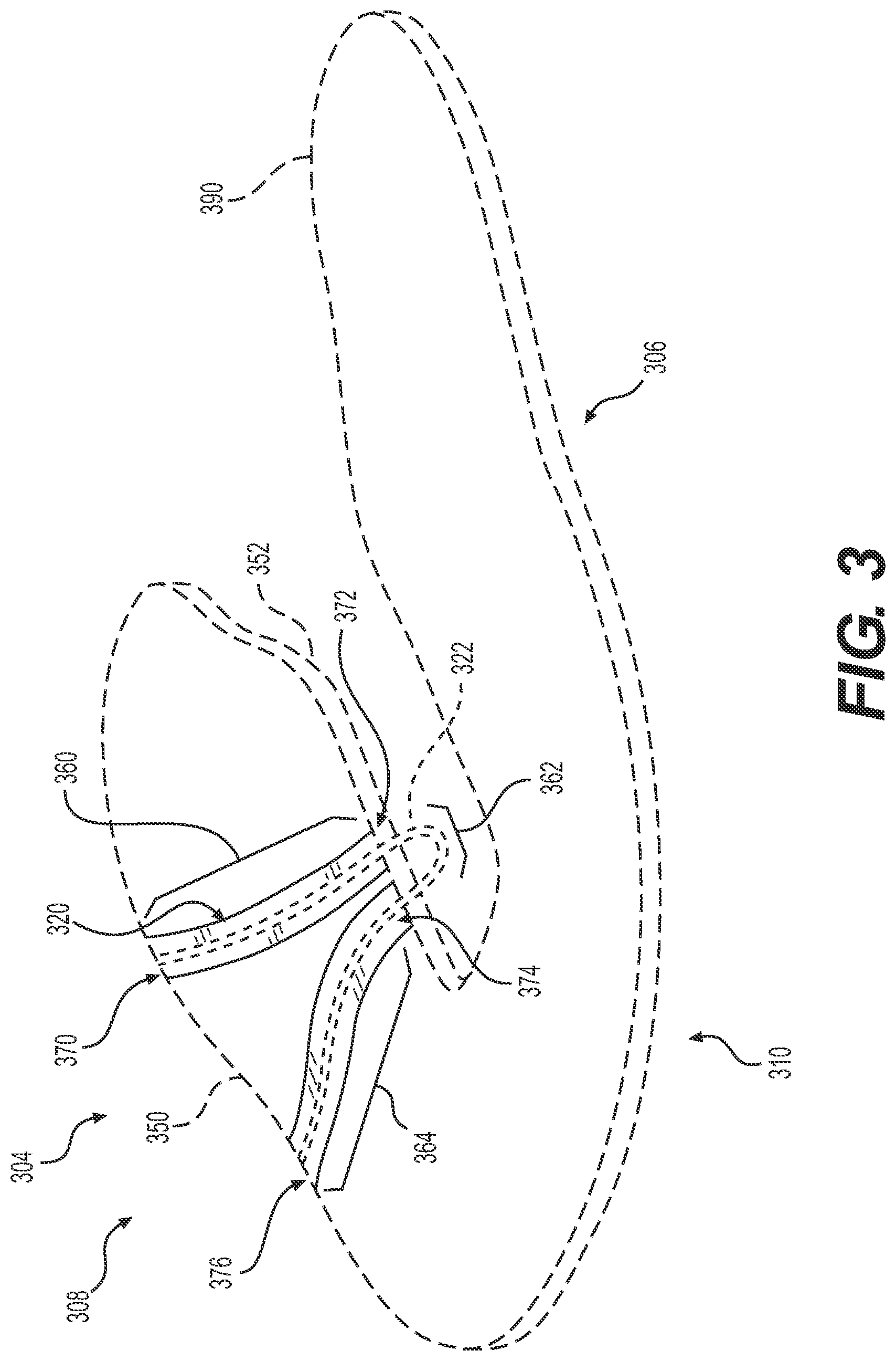 Patent US12317962 Figure 3 – Three-dimensional printing of a traced element