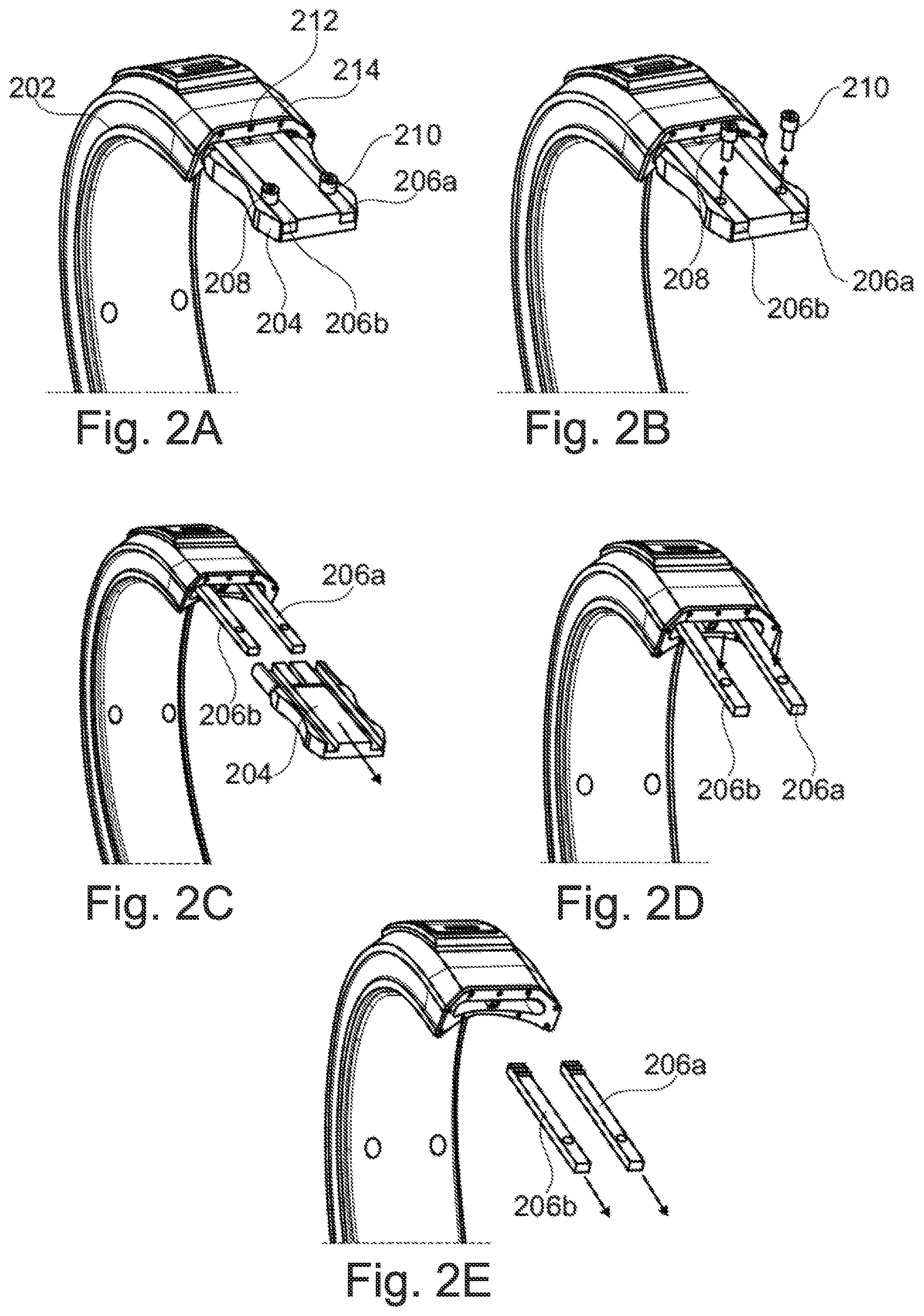 Patent US12317974 Figure 2 – Method of manufacturing a strap for a wearable device
