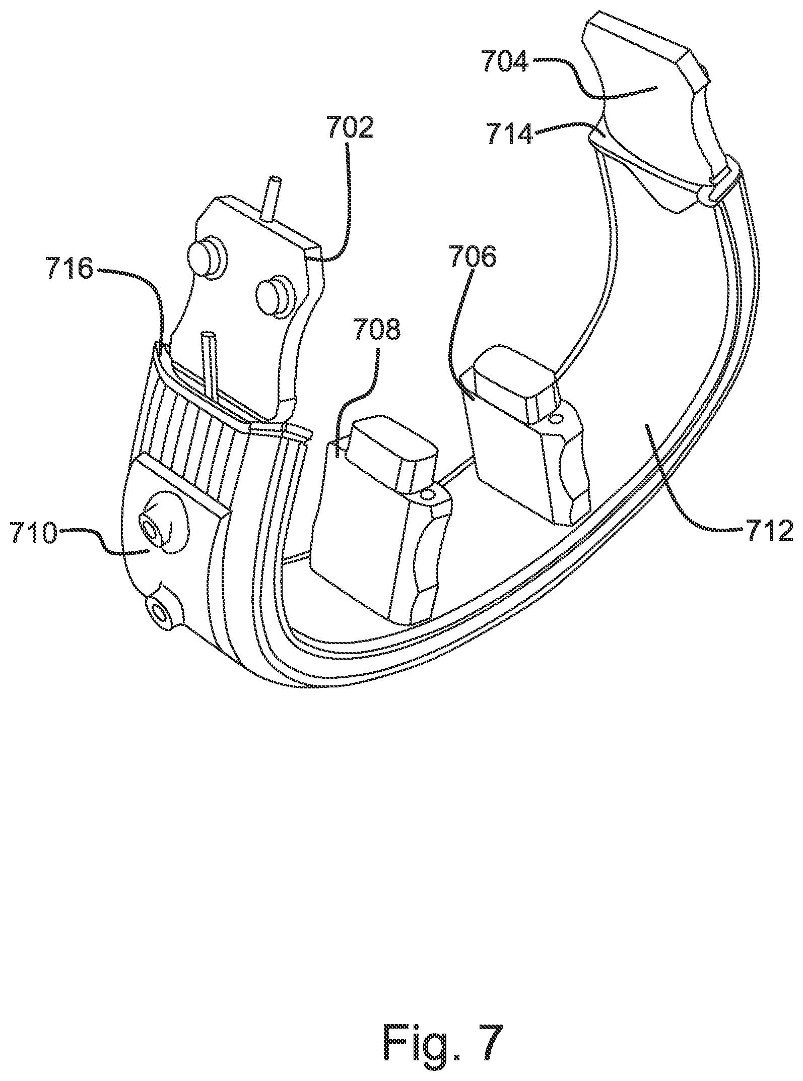 Patent US12317974 Figure 7 – Method of manufacturing a strap for a wearable device