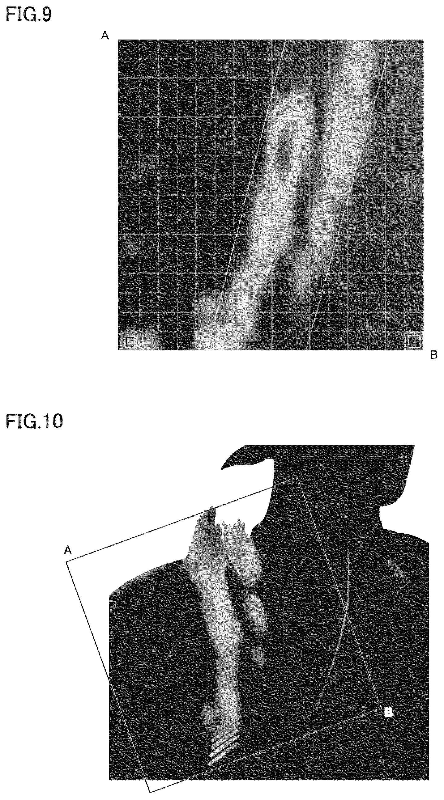 Patent US12317987 Figure 7 – Shoulder belt and bag