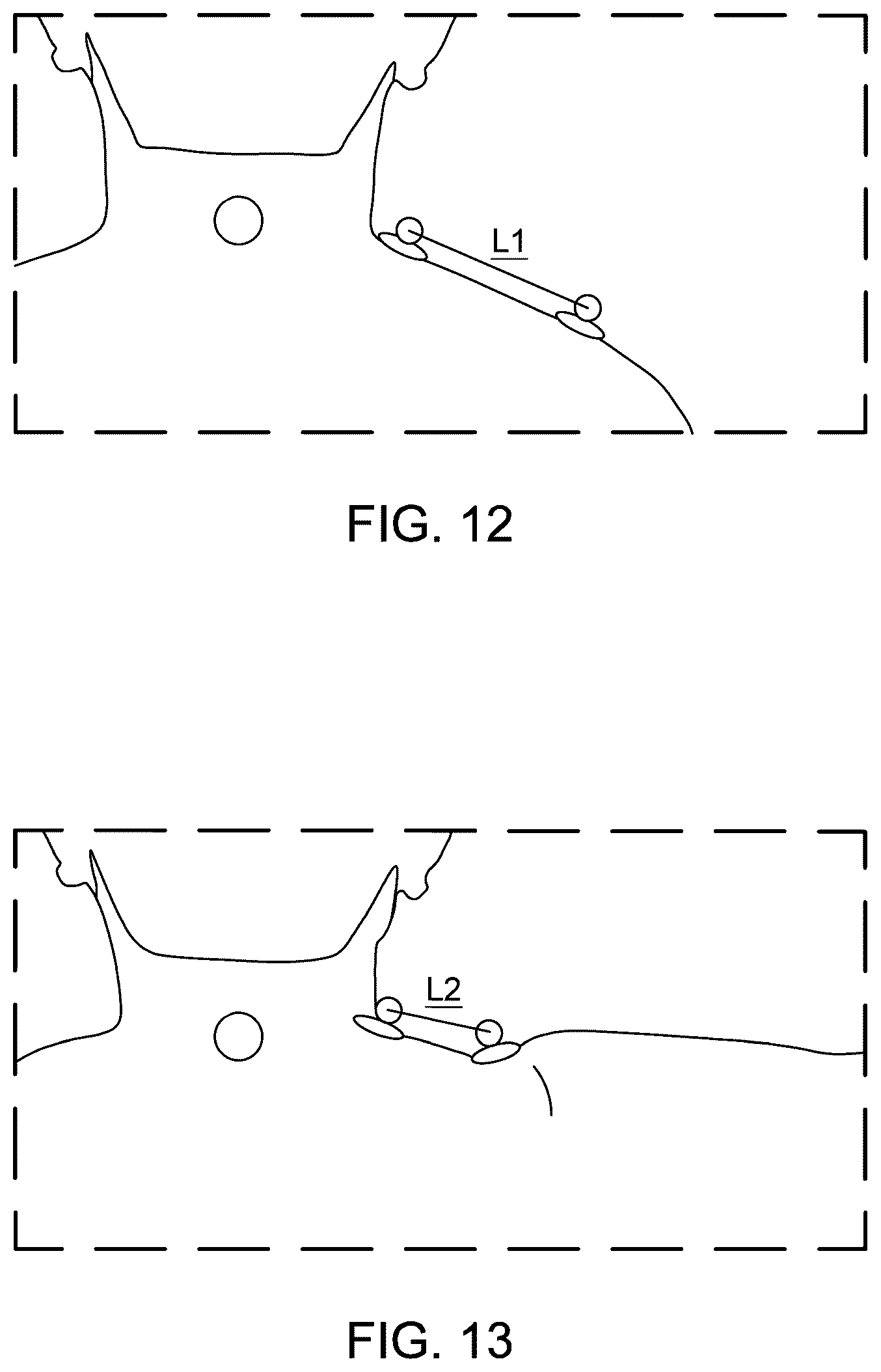 Patent US12317987 Figure 9 – Shoulder belt and bag