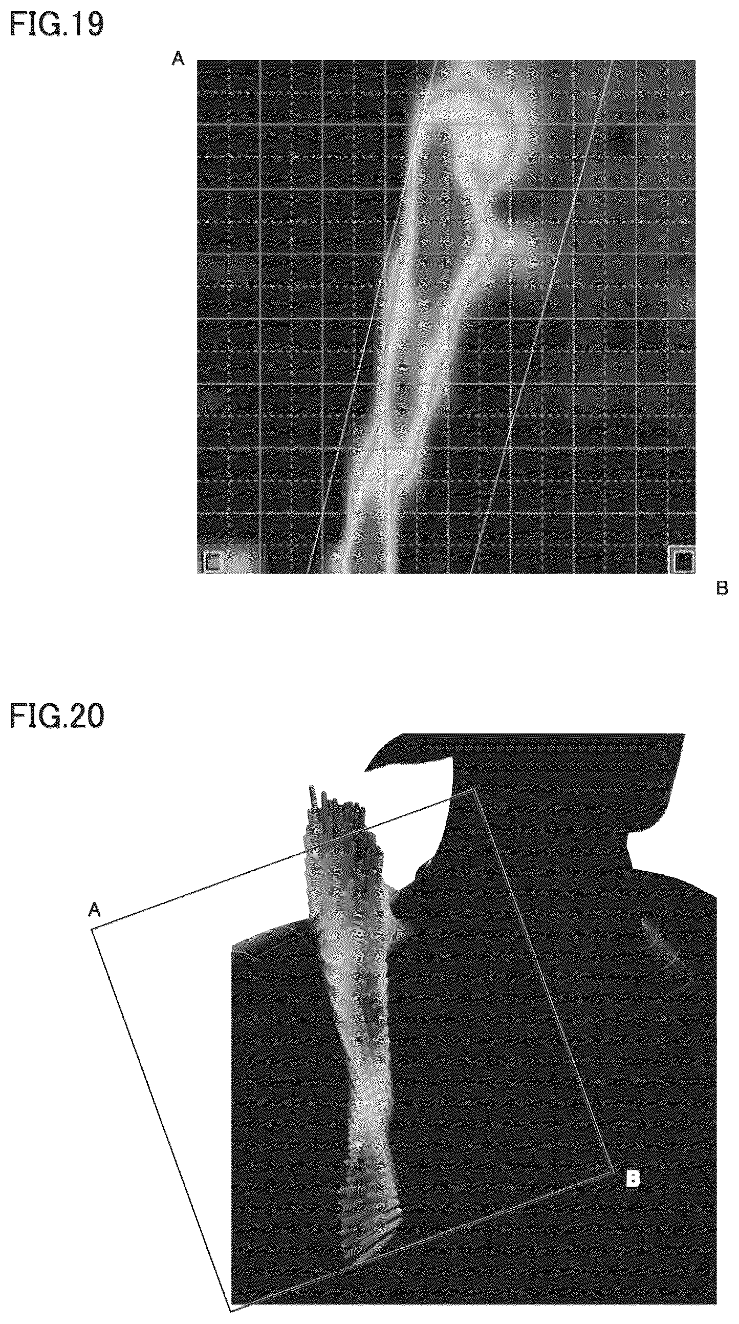 Patent US12317987 Figure 14 – Shoulder belt and bag