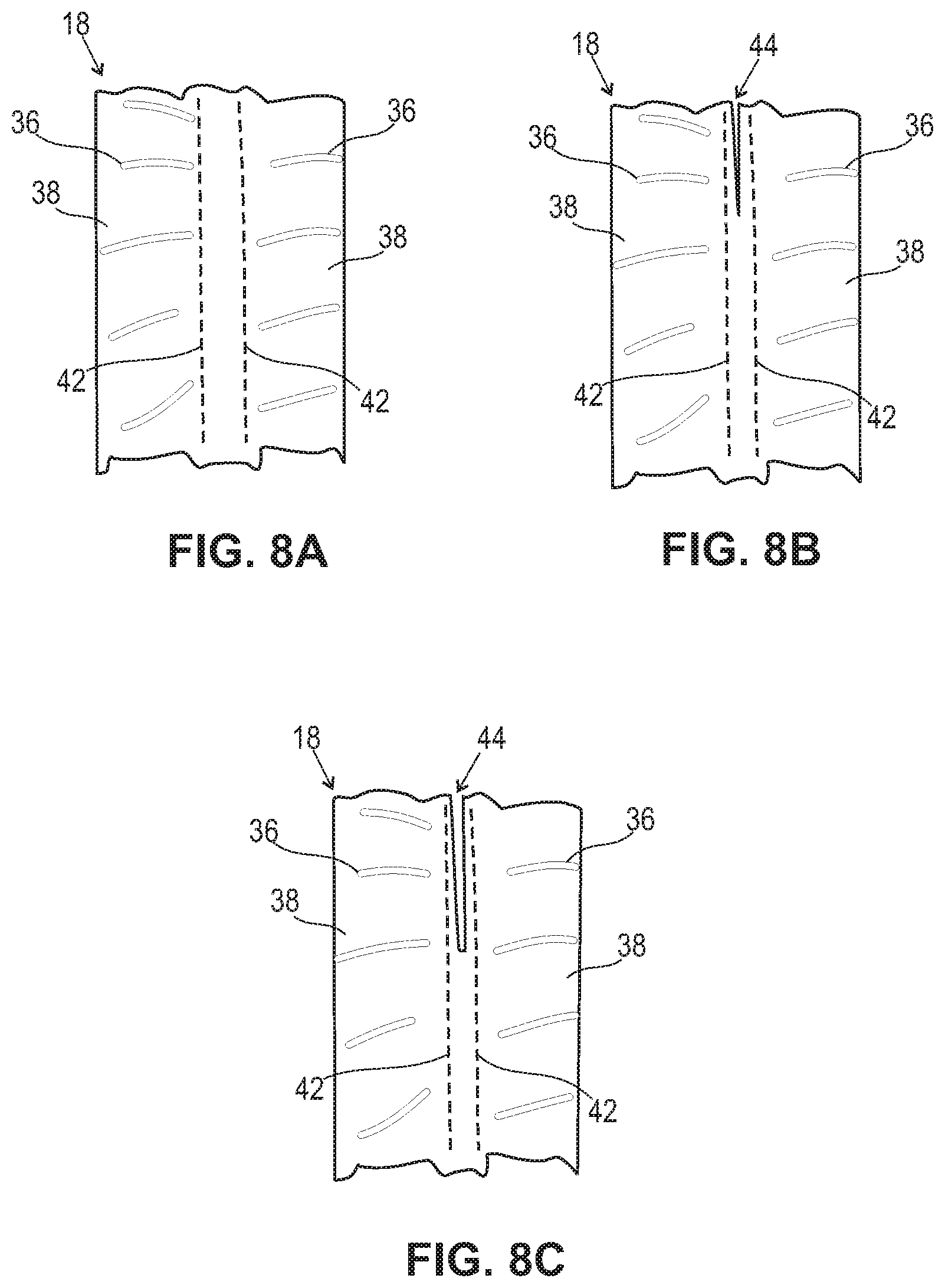 Patent US12318011 Figure 6 – Customizable mattress