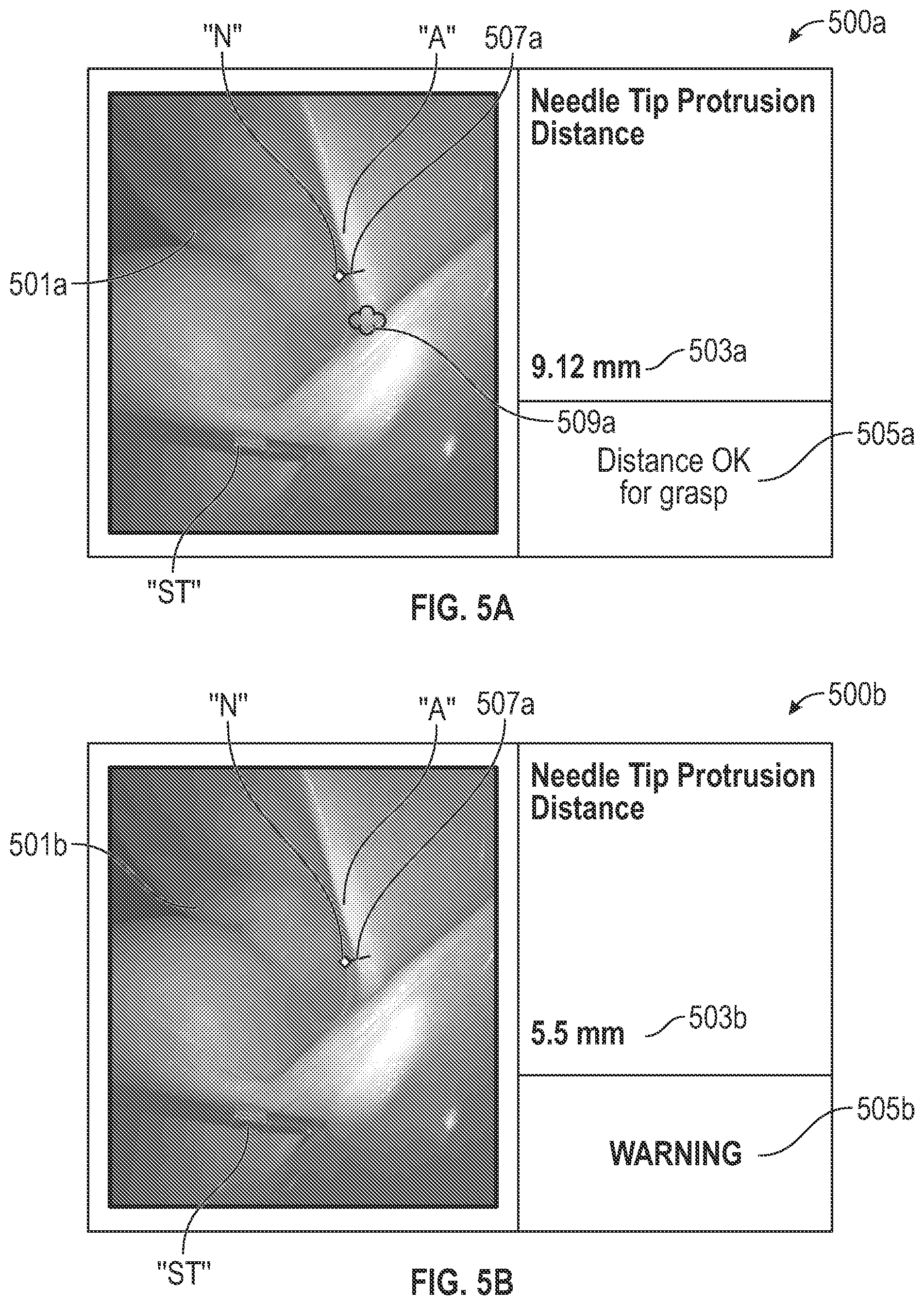 Patent US12318064 Figure 4 – Thoracic imaging, distance measuring, surgical awareness, and notification system and method