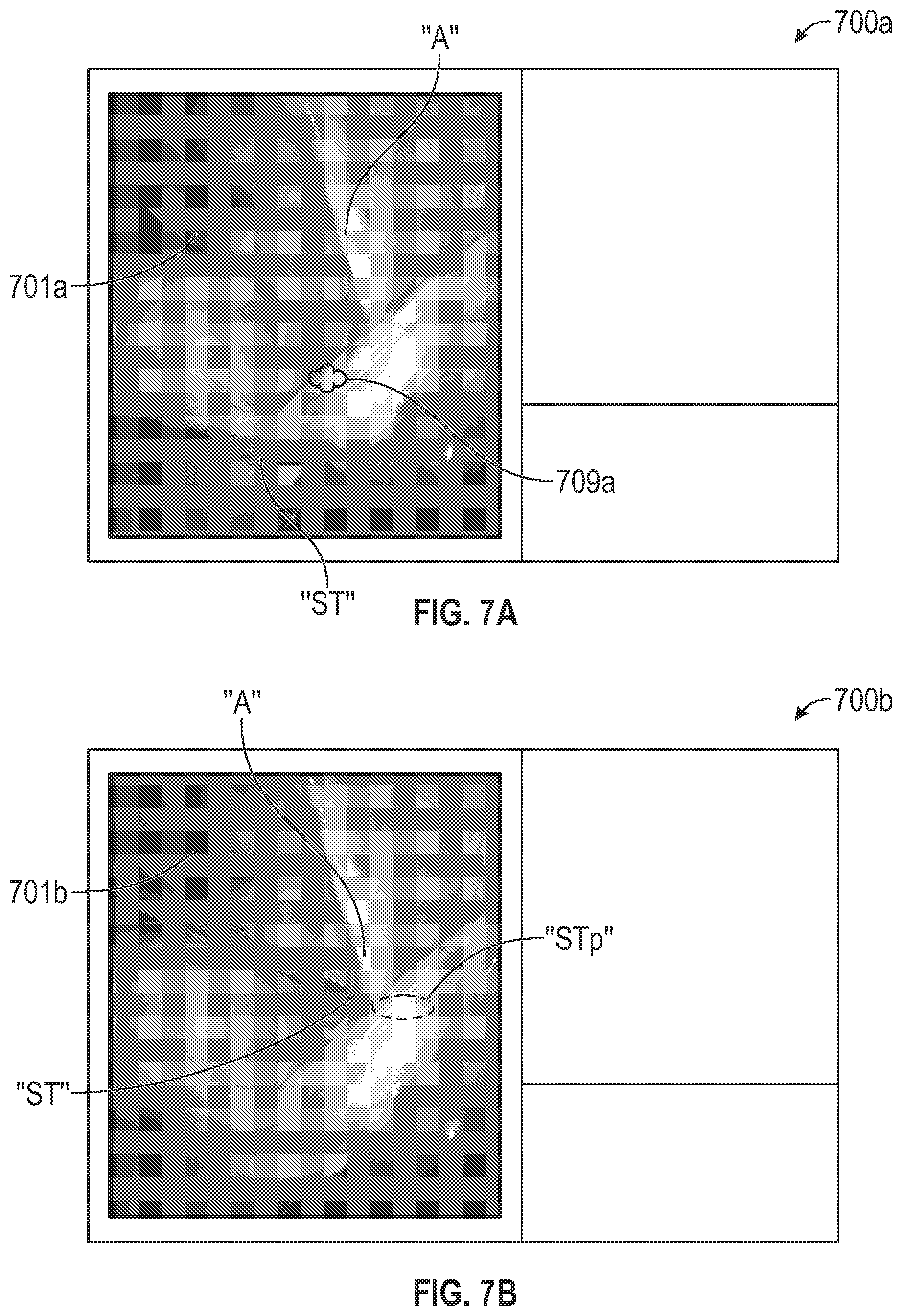 Patent US12318064 Figure 7 – Thoracic imaging, distance measuring, surgical awareness, and notification system and method