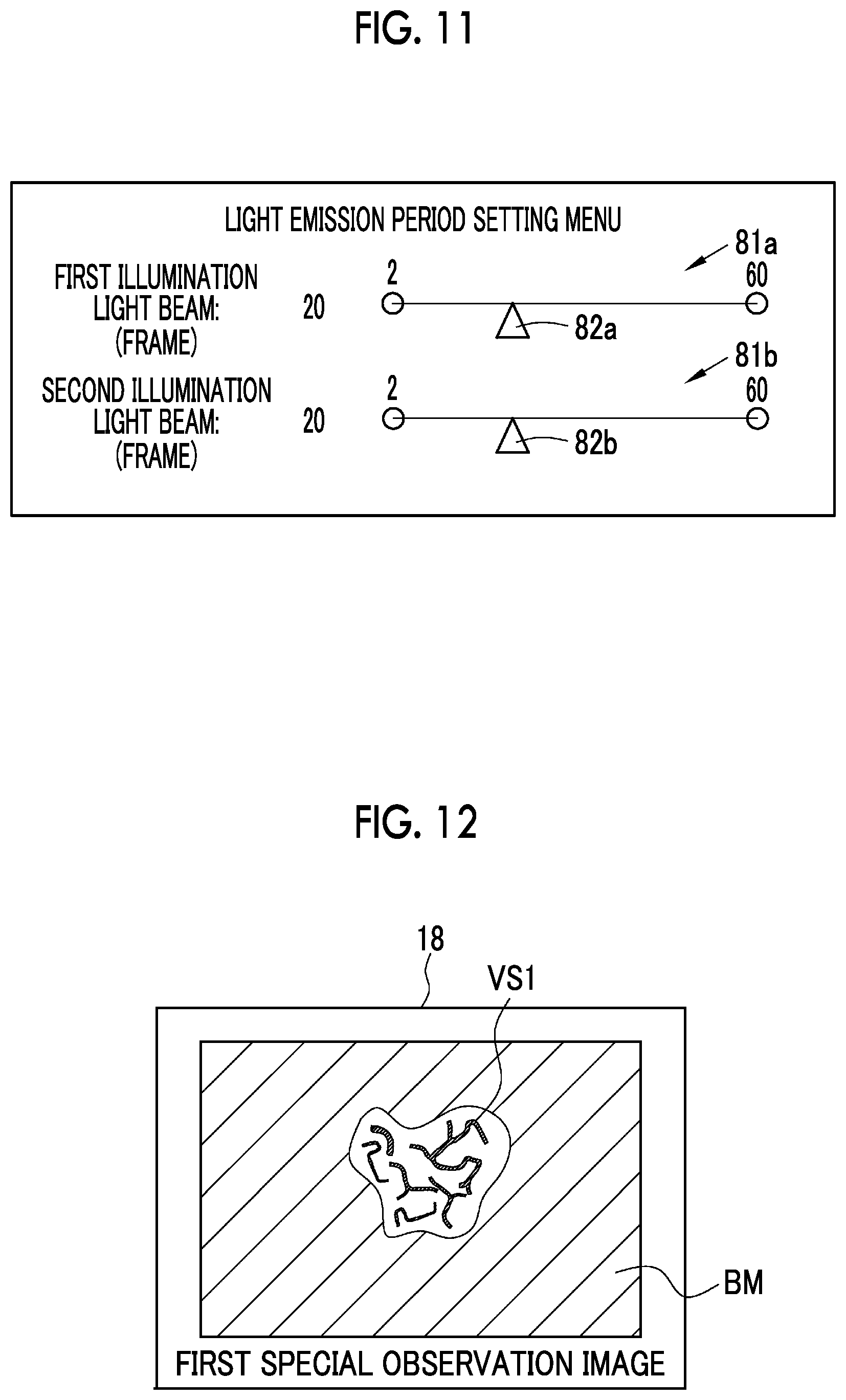Patent US12318071 Figure 9 – Endoscope system and method of operating endoscope system