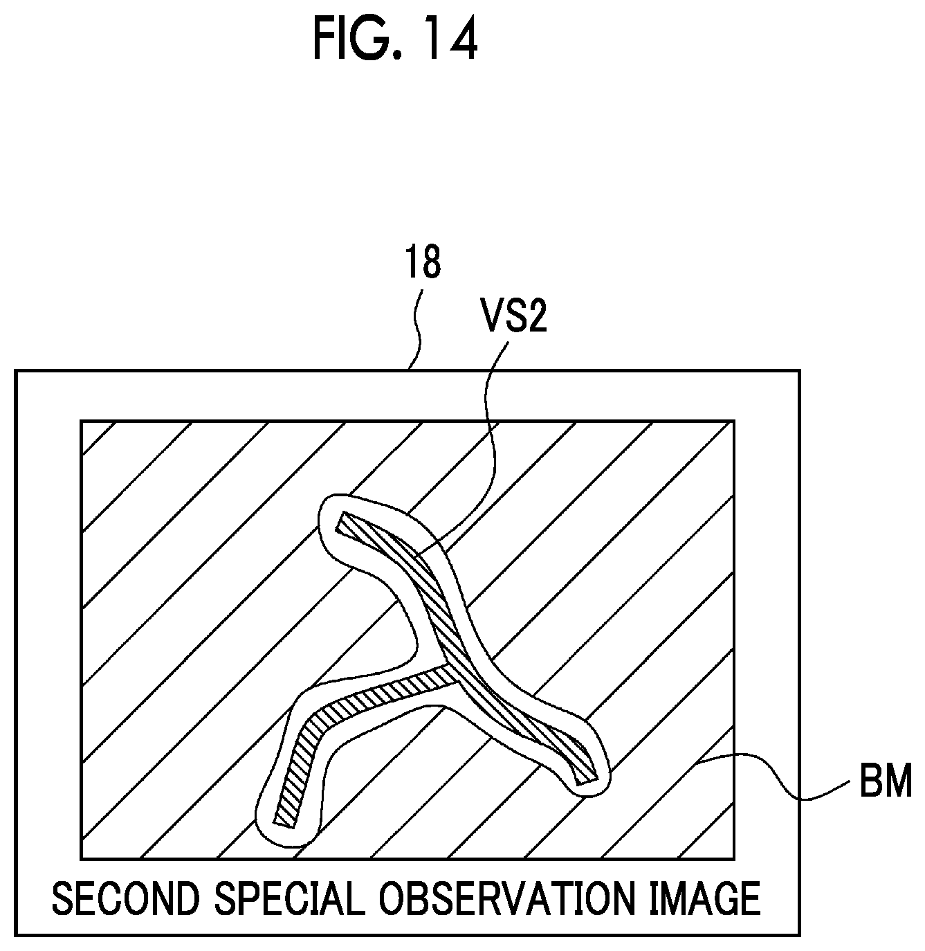 Patent US12318071 Figure 11 – Endoscope system and method of operating endoscope system