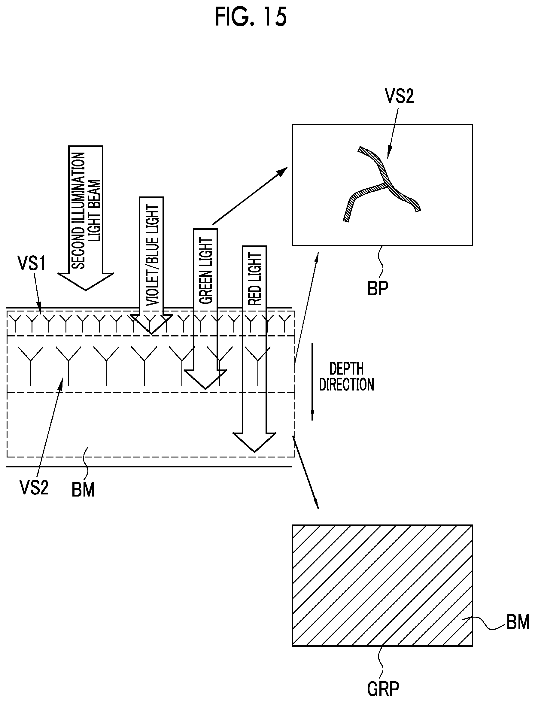 Patent US12318071 Figure 12 – Endoscope system and method of operating endoscope system