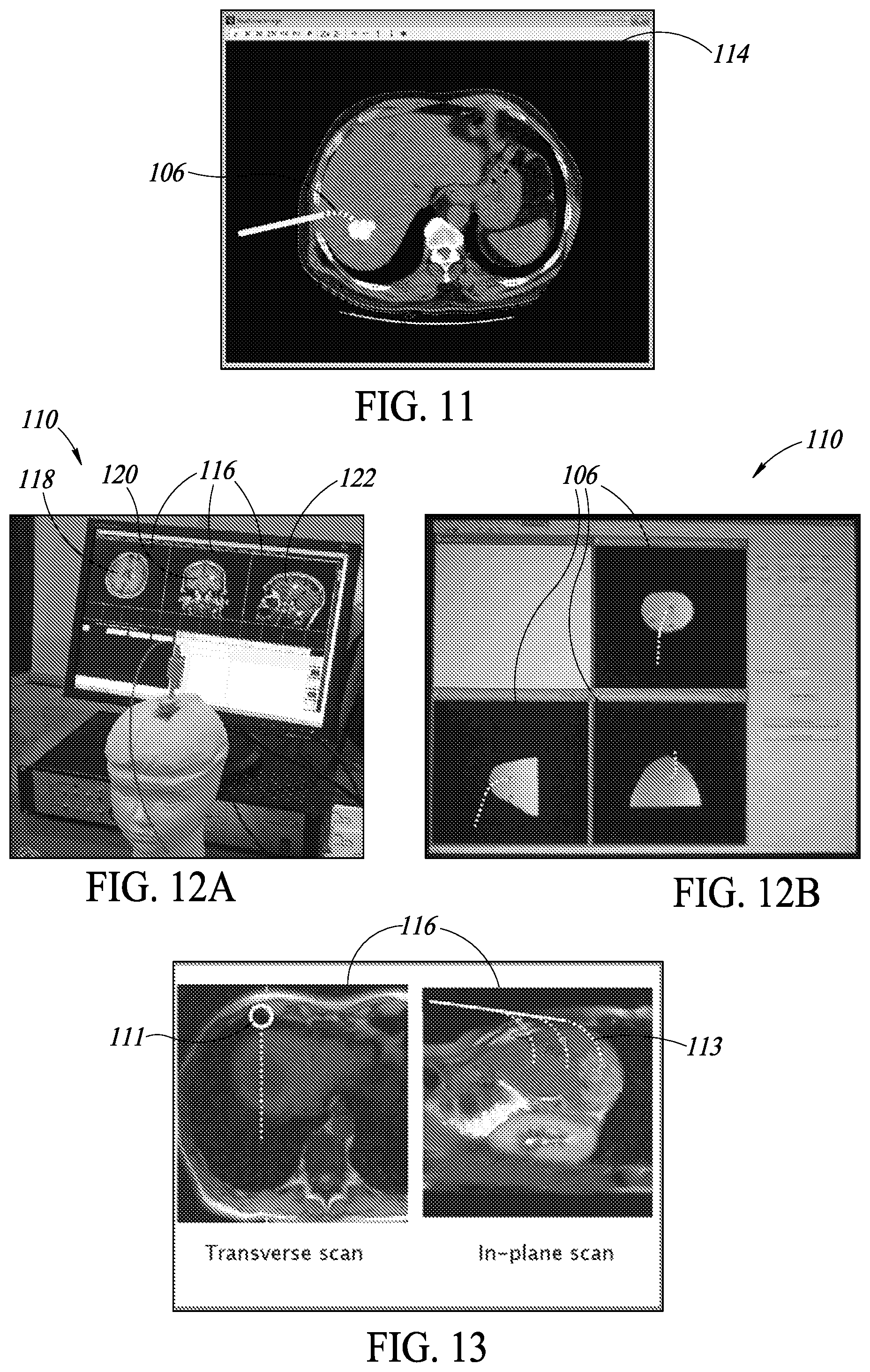 Patent US12318076 Figure 13 – Curved needle core biopsy system