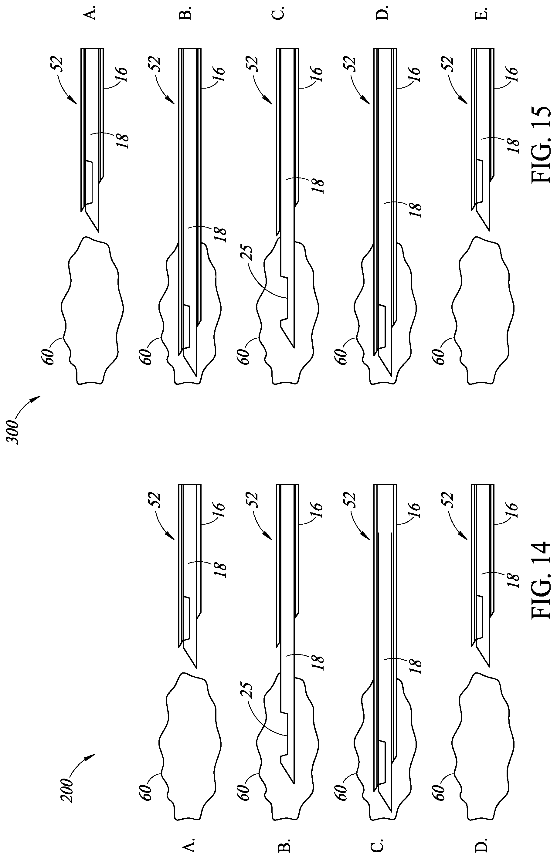 Patent US12318076 Figure 14 – Curved needle core biopsy system