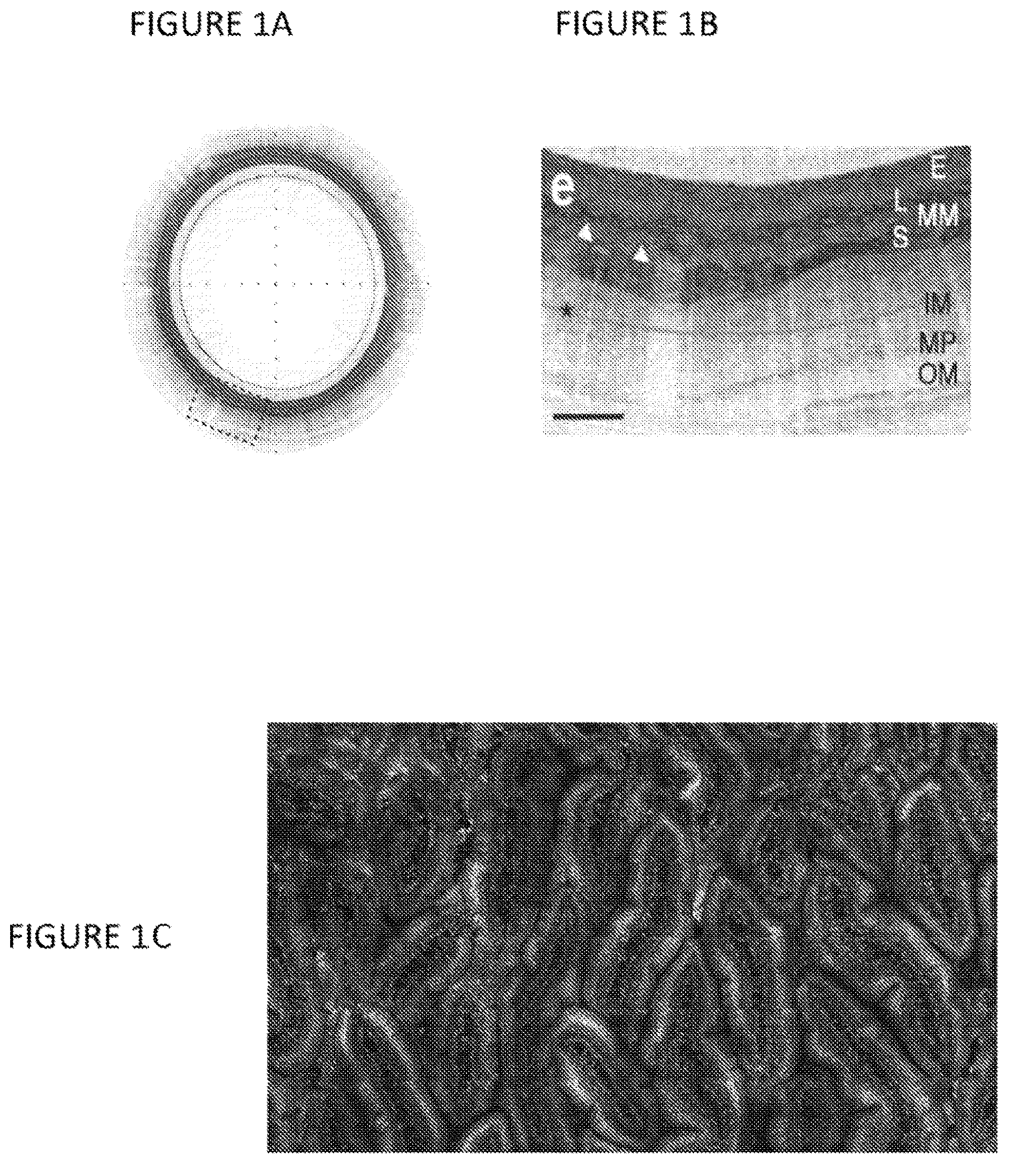 Patent US12318077 Figure 1 – Apparatus, method and computer-accessible medium for obtaining tissue samples