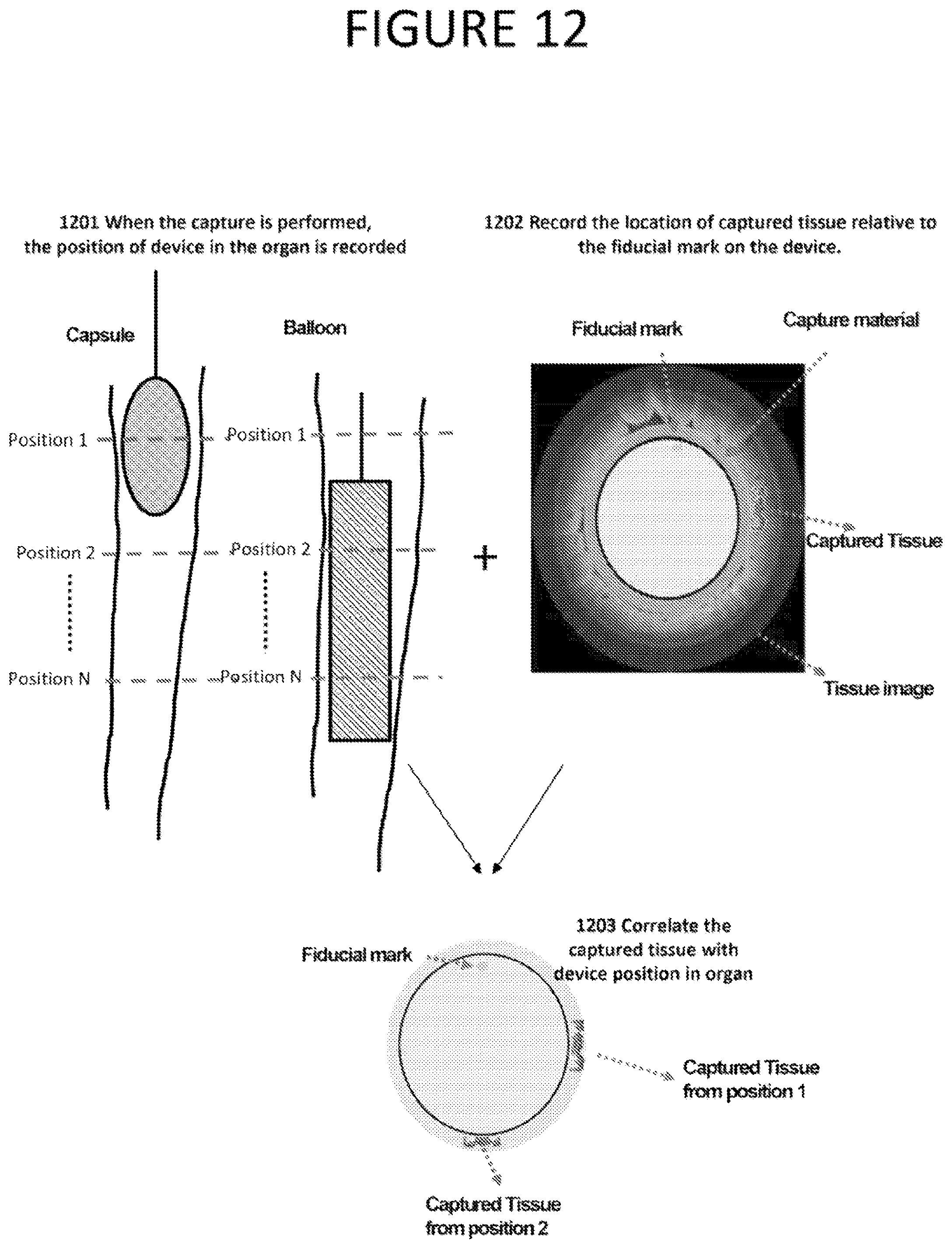 Patent US12318077 Figure 12 – Apparatus, method and computer-accessible medium for obtaining tissue samples