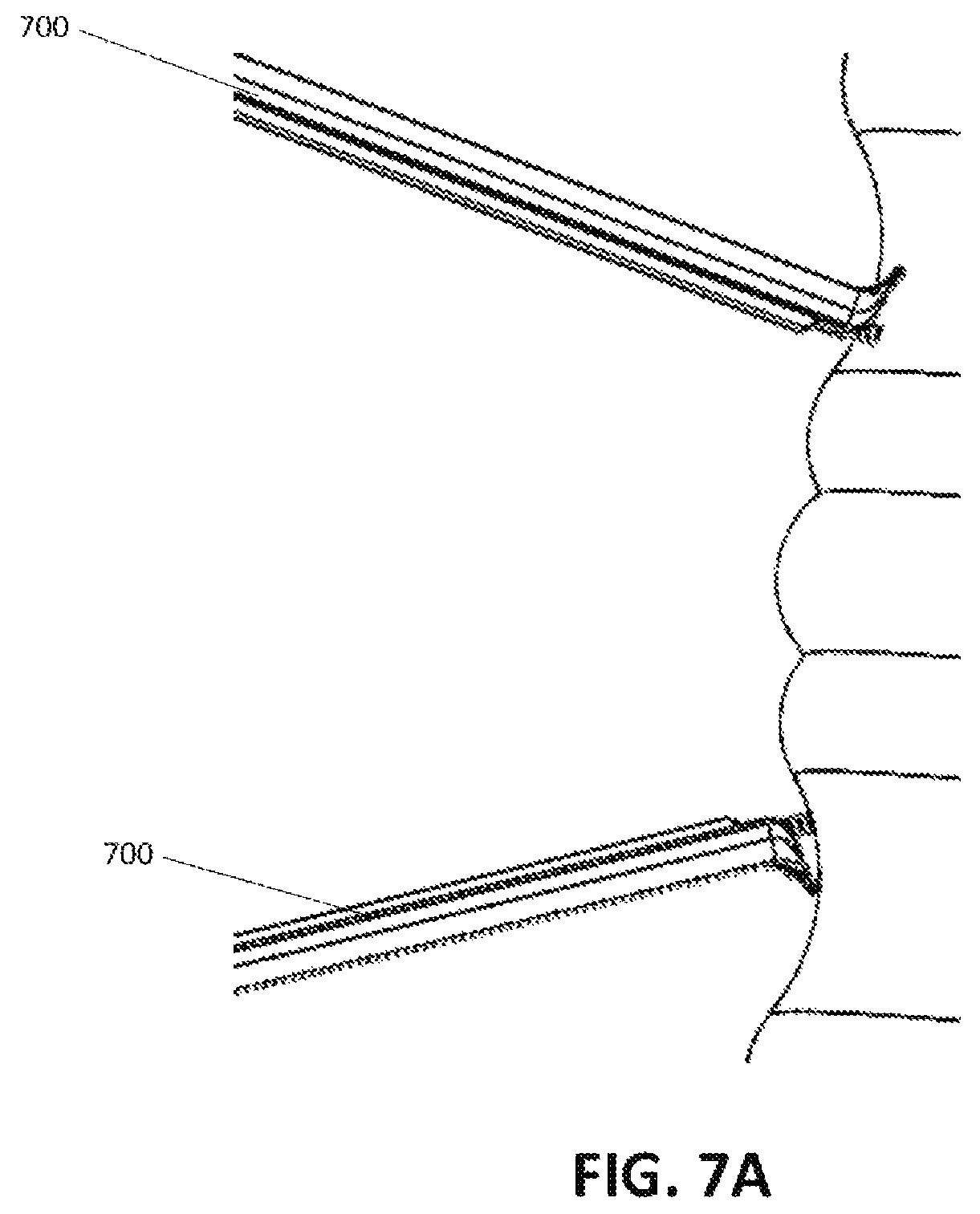 Patent US12318080 Figure 11 – Illuminated surgical retractor capable of hand-held operation and of being mounted to a fixed frame
