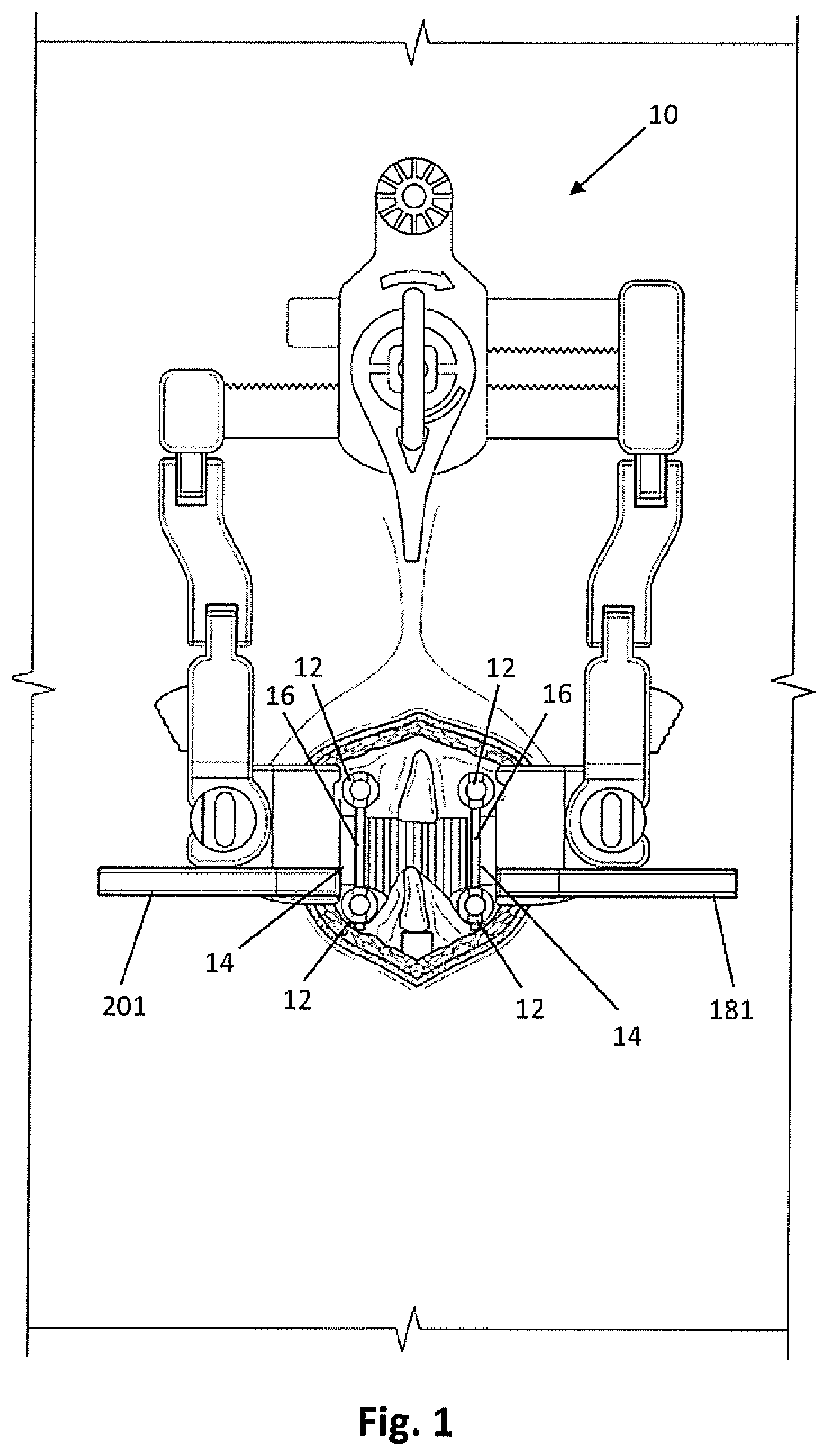 Patent US12318081 Figure 1 – Systems and methods for performing spine surgery