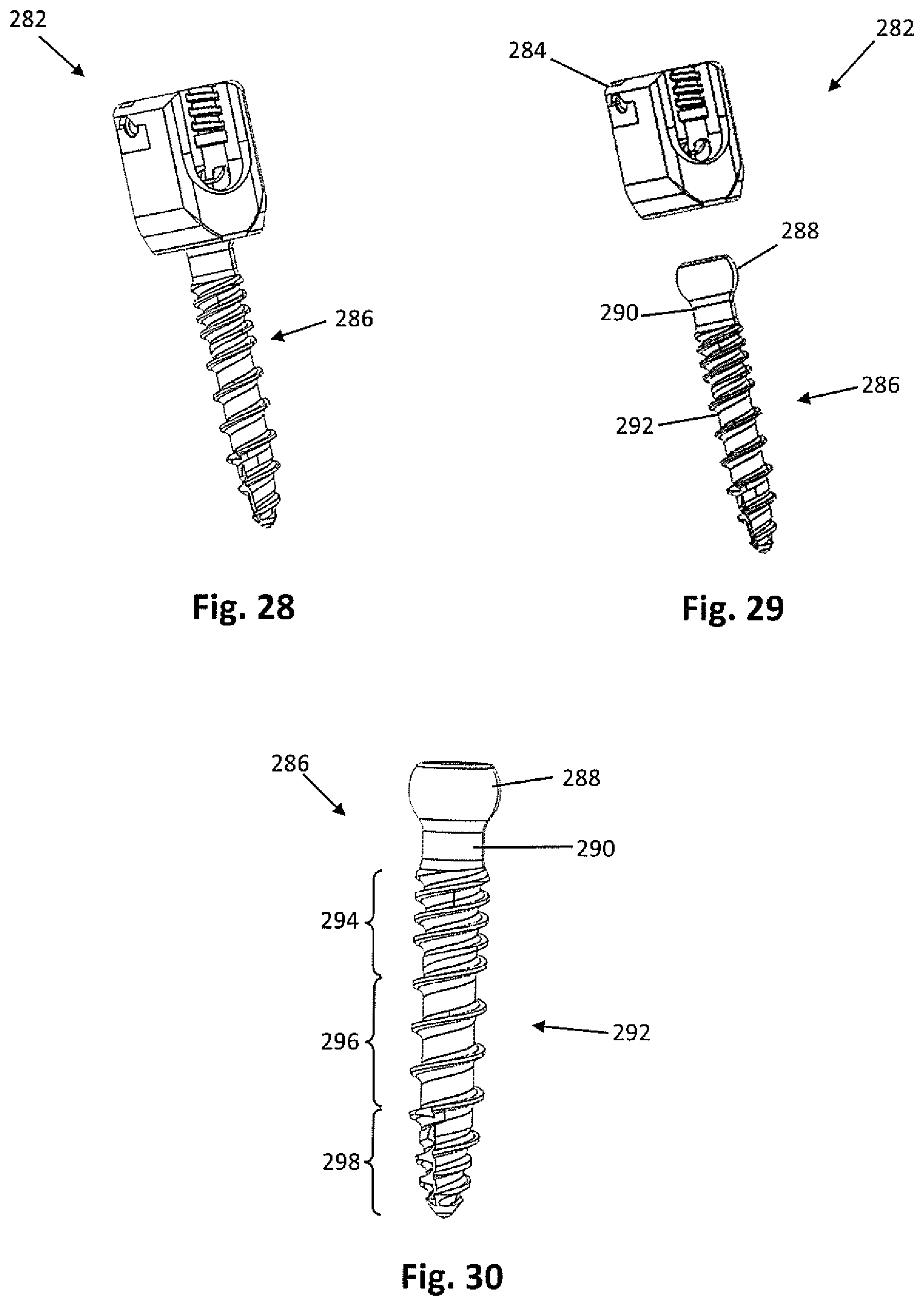 Patent US12318081 Figure 10 – Systems and methods for performing spine surgery