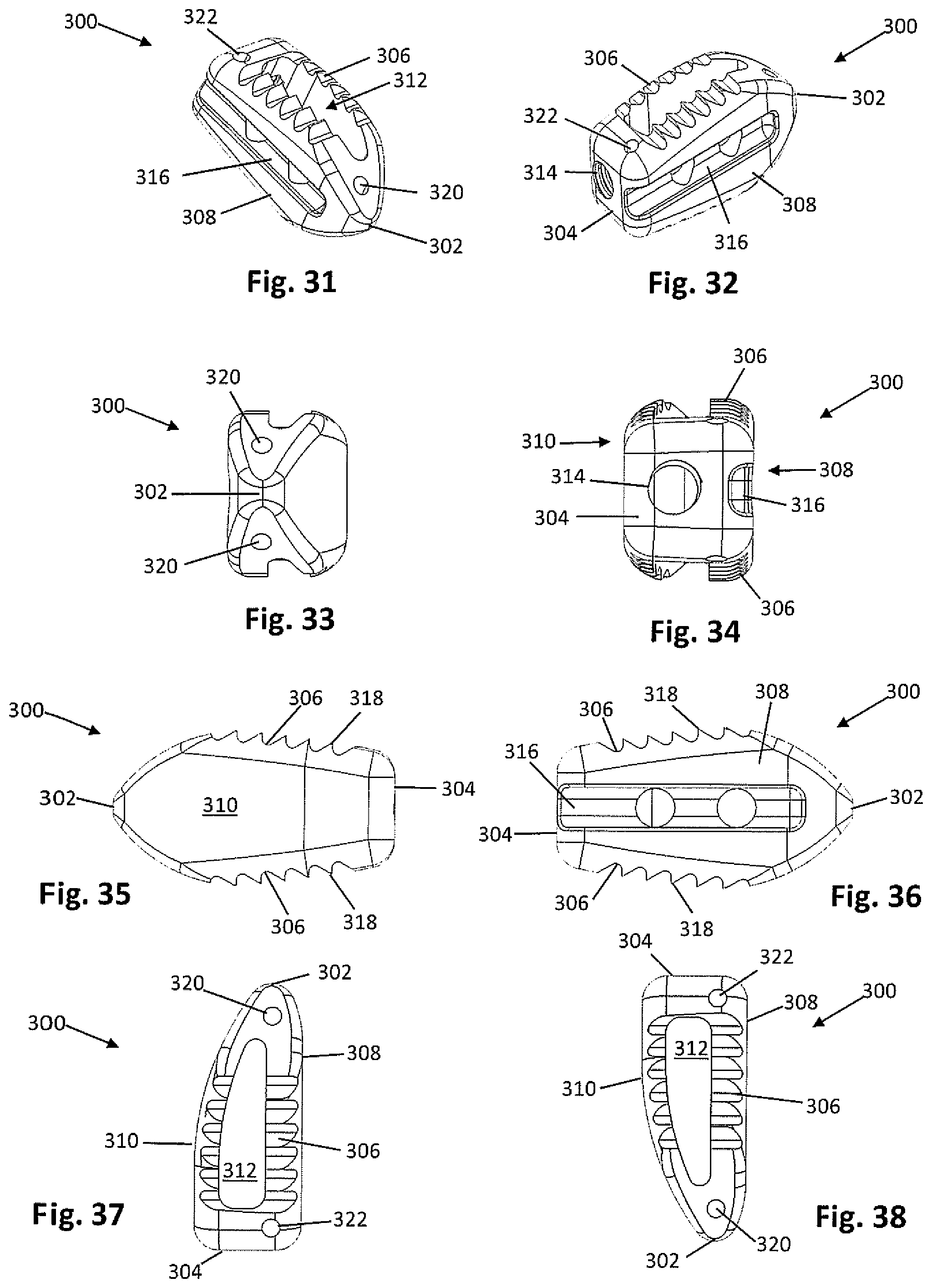 Patent US12318081 Figure 11 – Systems and methods for performing spine surgery