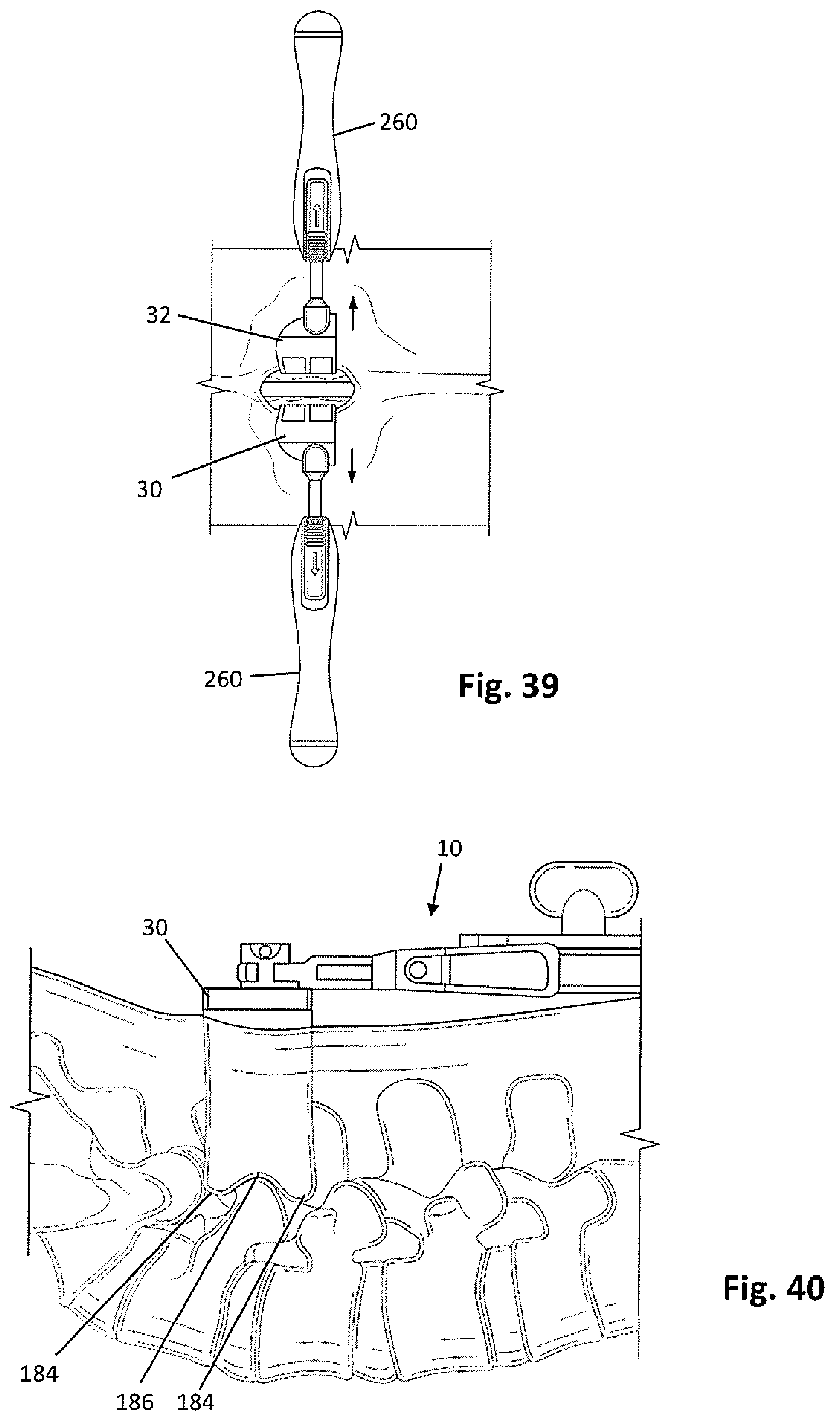 Patent US12318081 Figure 12 – Systems and methods for performing spine surgery