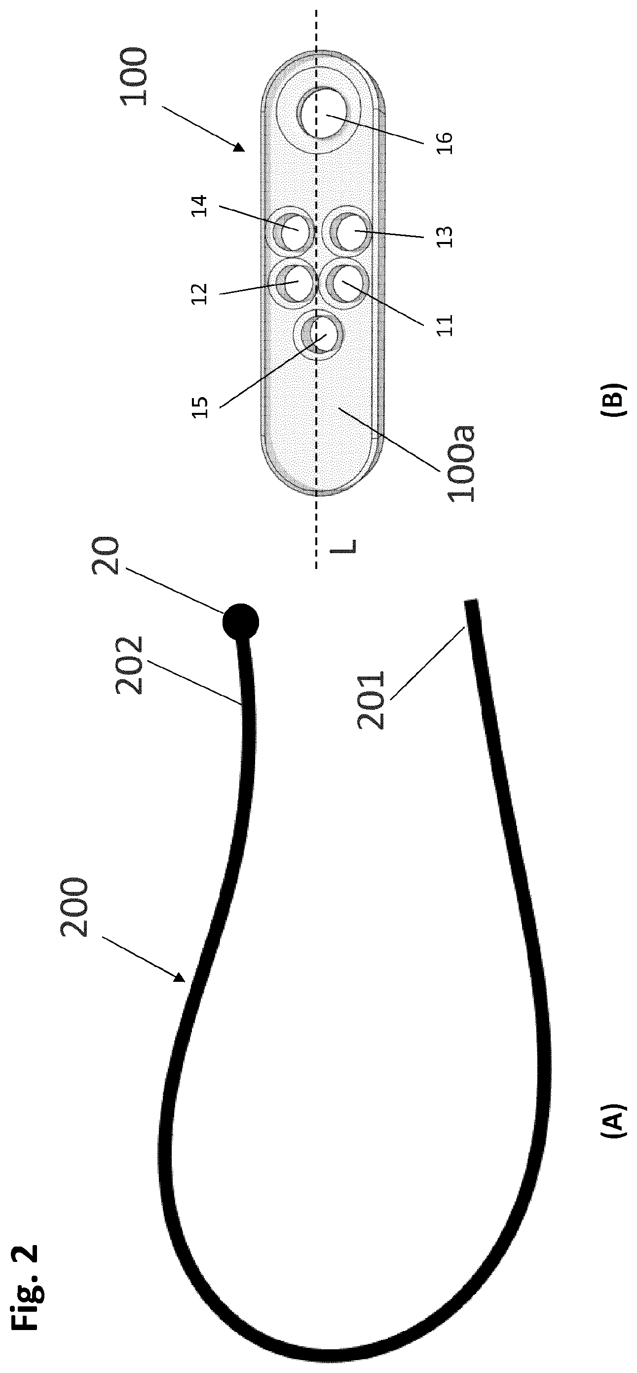 Patent US12318083 Figure 2 – Single strand self-locking suspension device for medical use