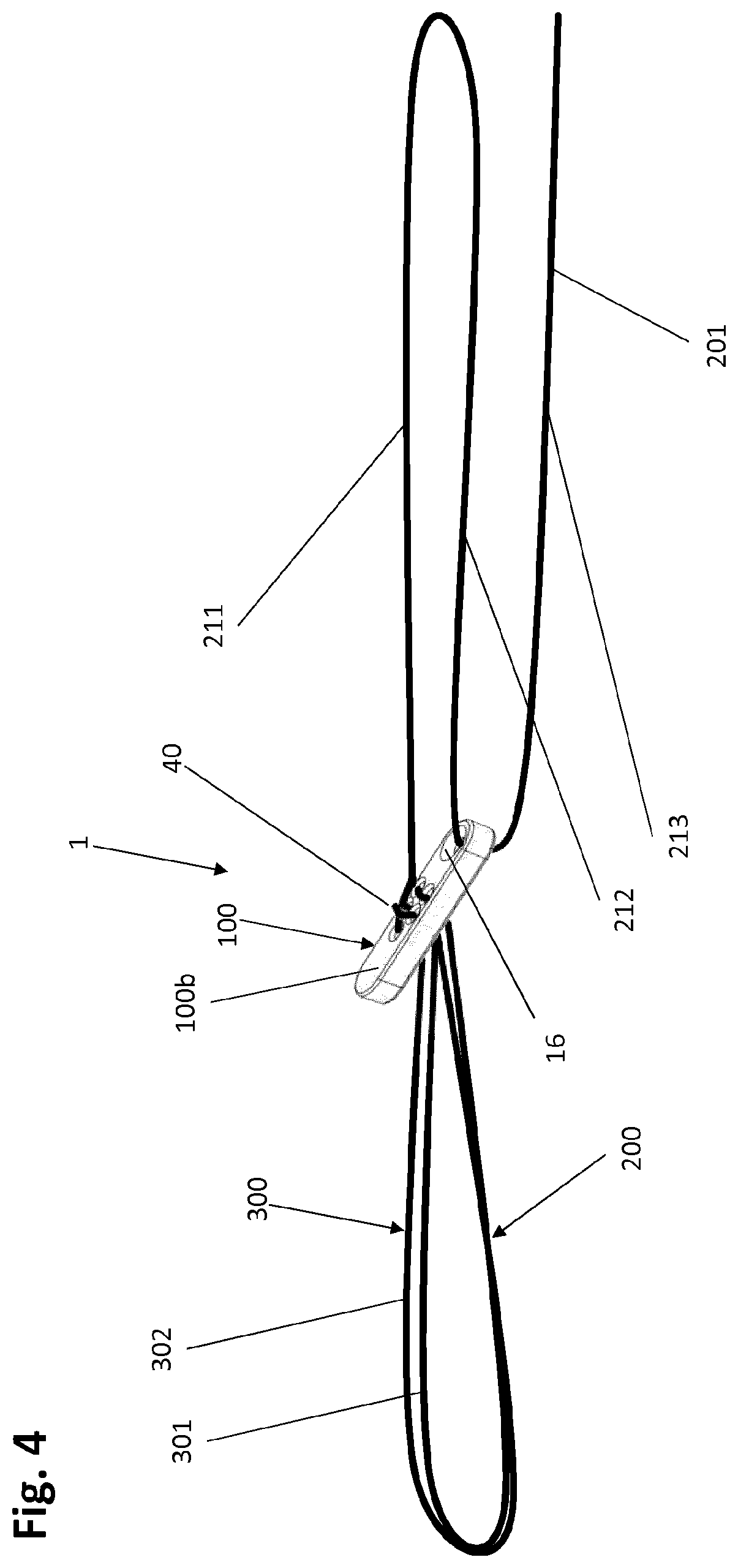 Patent US12318083 Figure 6 – Single strand self-locking suspension device for medical use