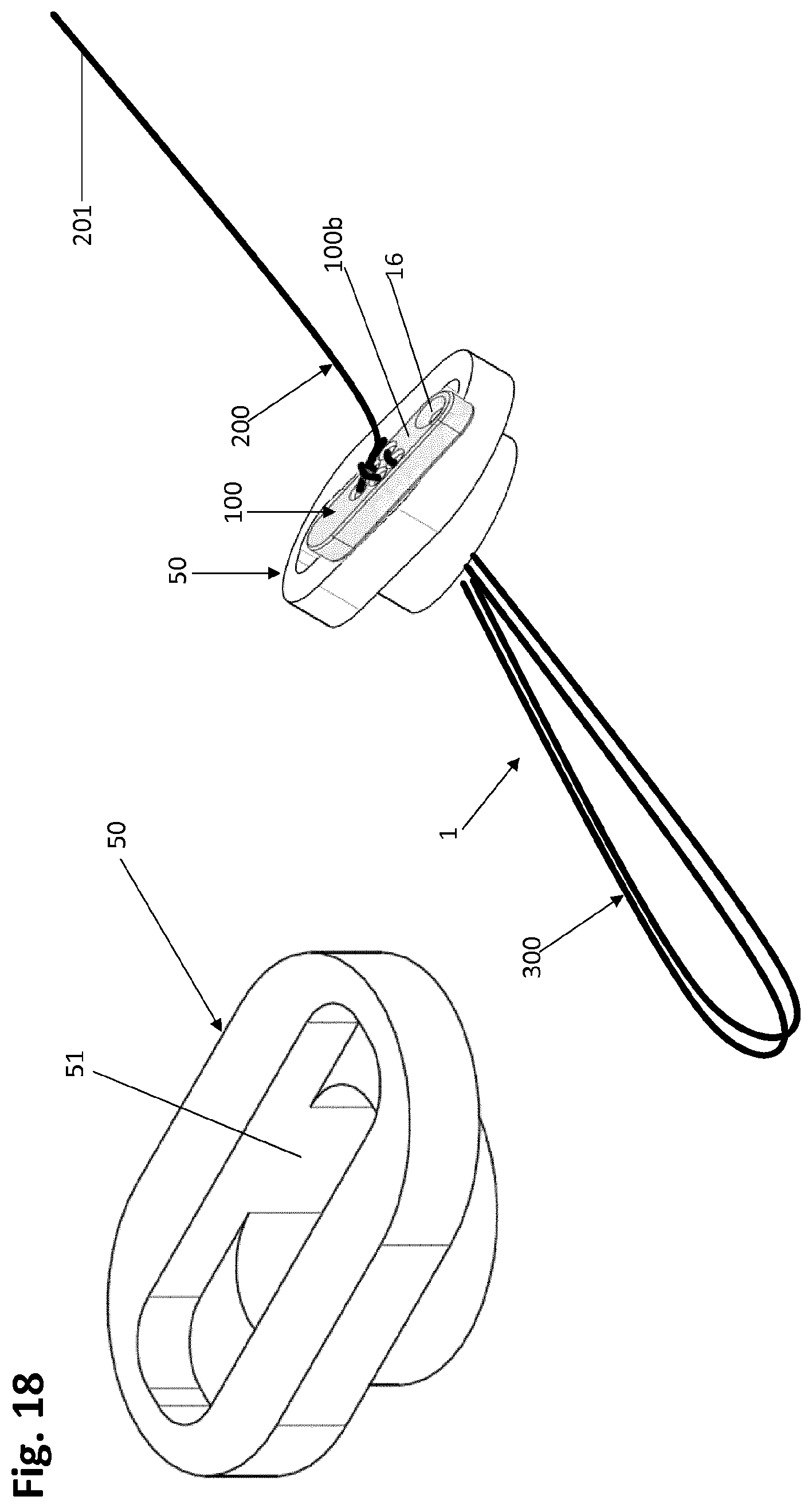 Patent US12318083 Figure 20 – Single strand self-locking suspension device for medical use