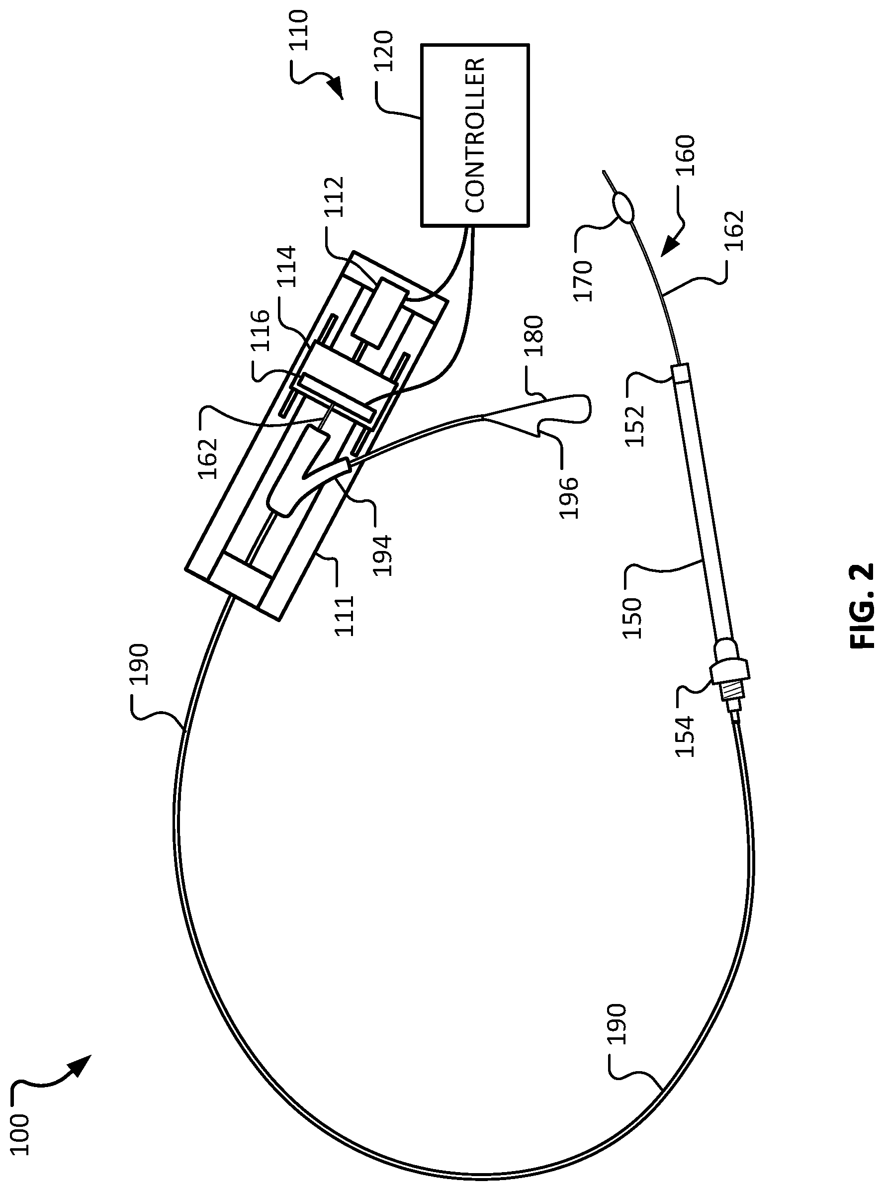 Patent US12318084 Figure 2 – Medical devices and methods for body conduit lengthening and anastomosis formation