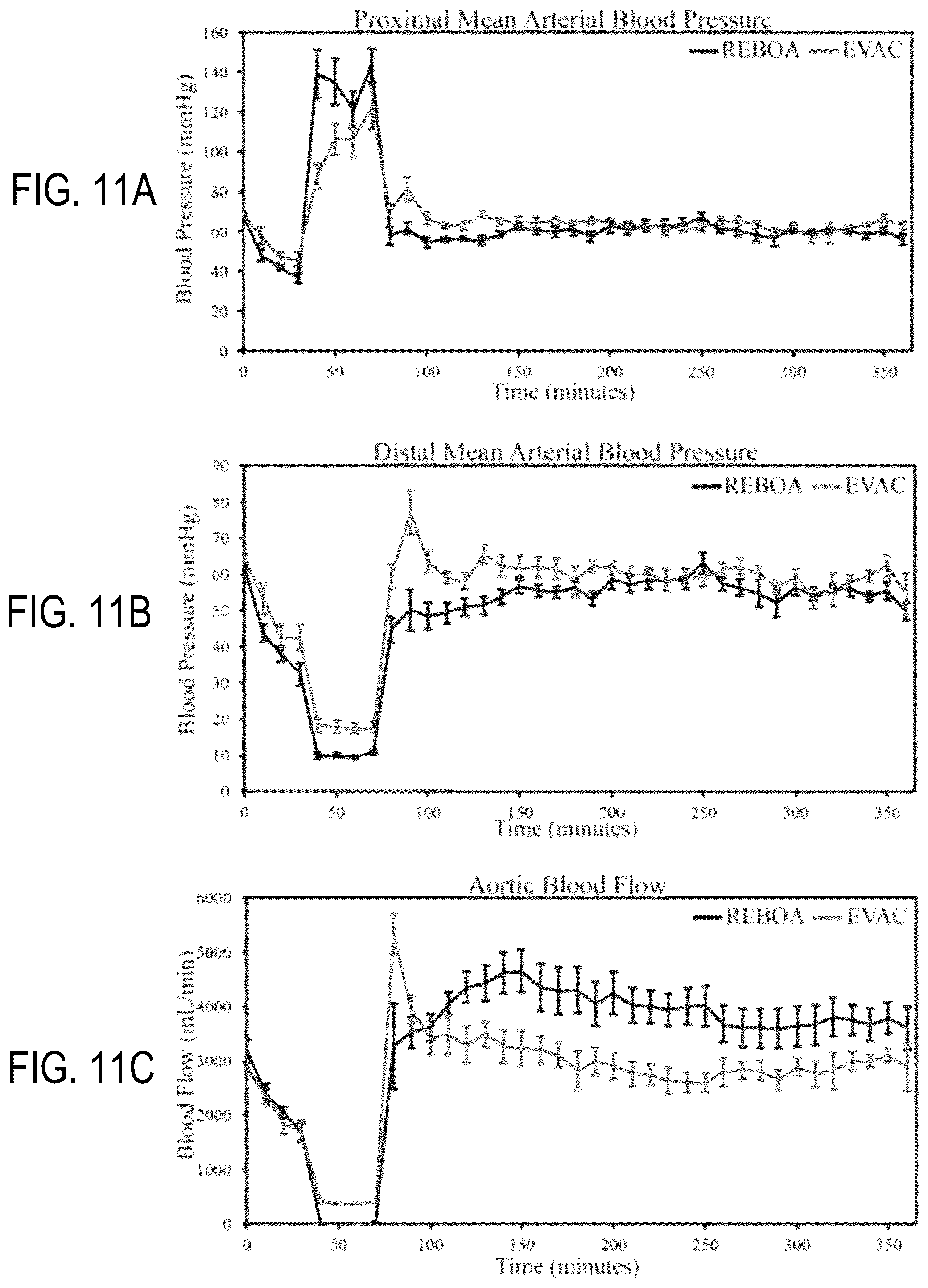 Patent US12318090 Figure 11 – Aortic flow meter and pump for partial-aortic occlusion