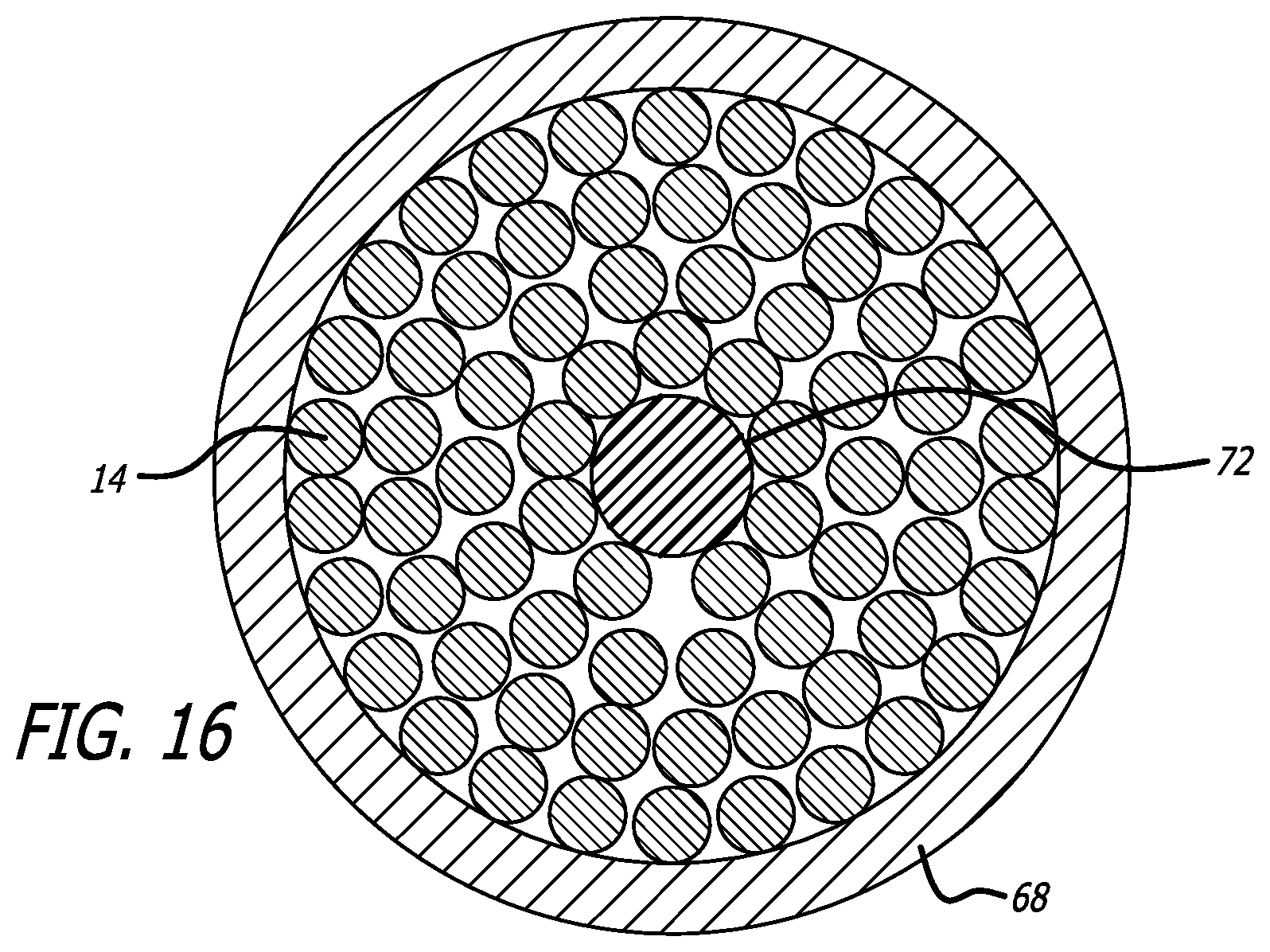 Patent US12318091 Figure 11 – Filamentary devices for treatment of vascular defects