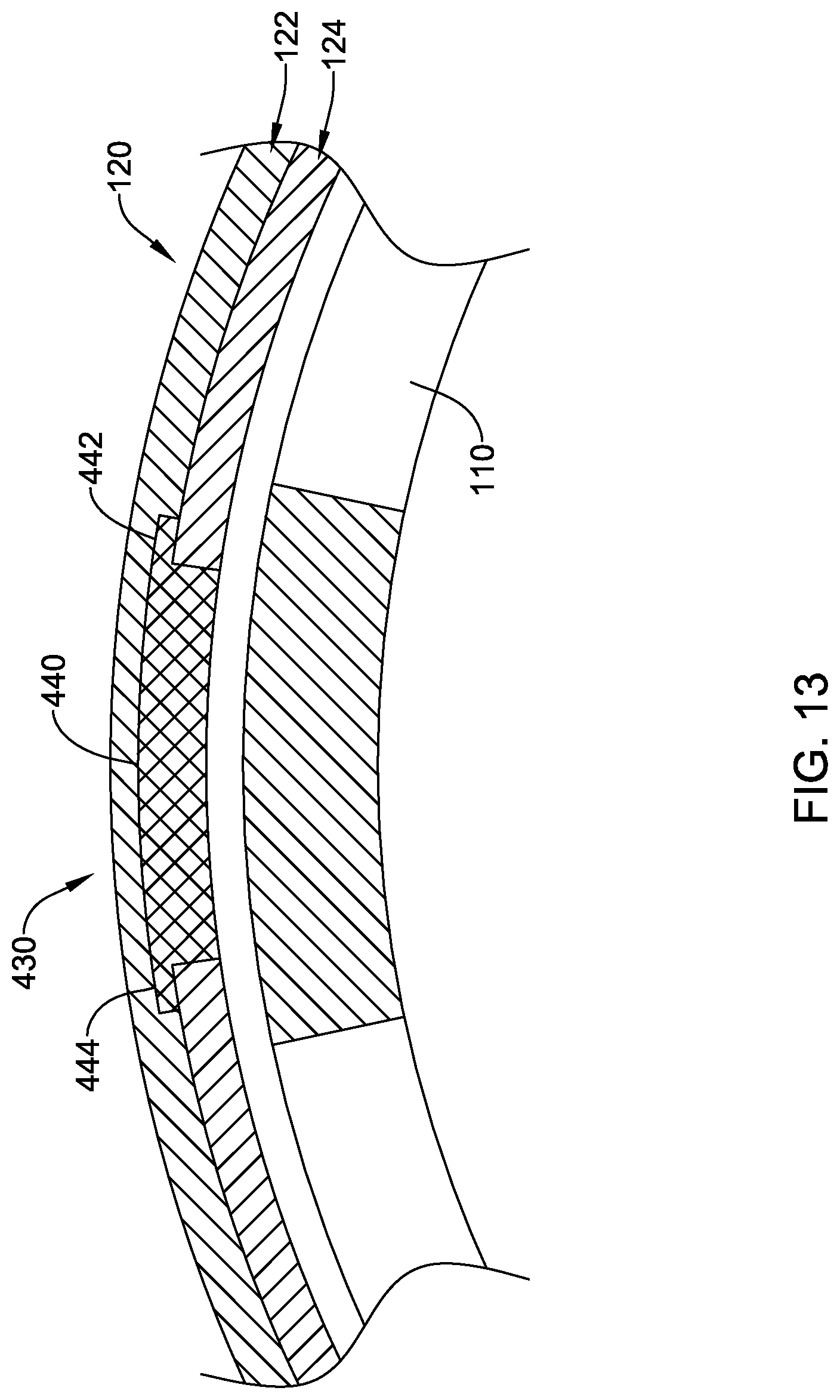 Patent US12318092 Figure 13 – Left atrial appendage implant