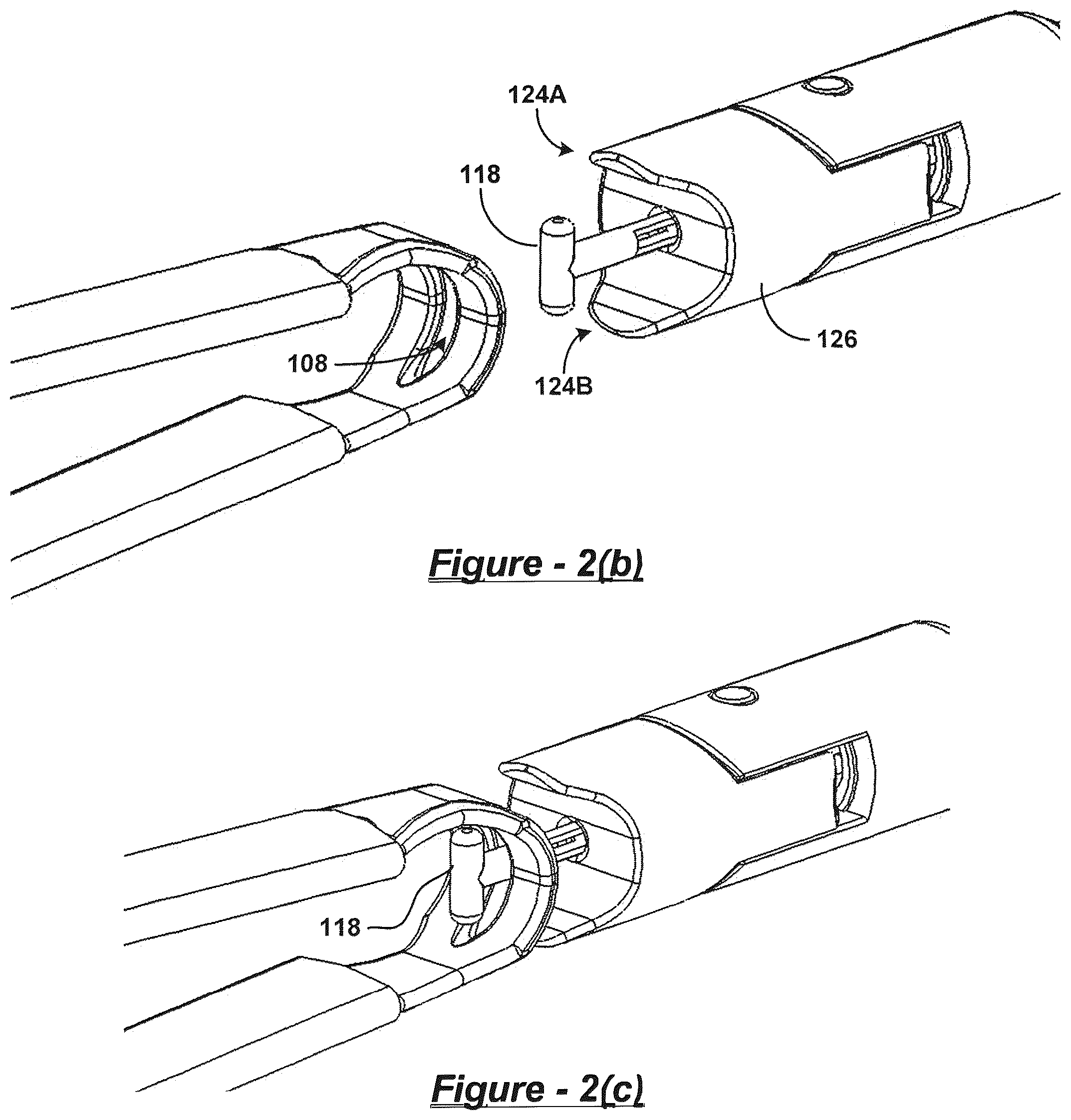 Patent US12318093 Figure 2 – Polymer overmolded bariatric clamp and method of installing