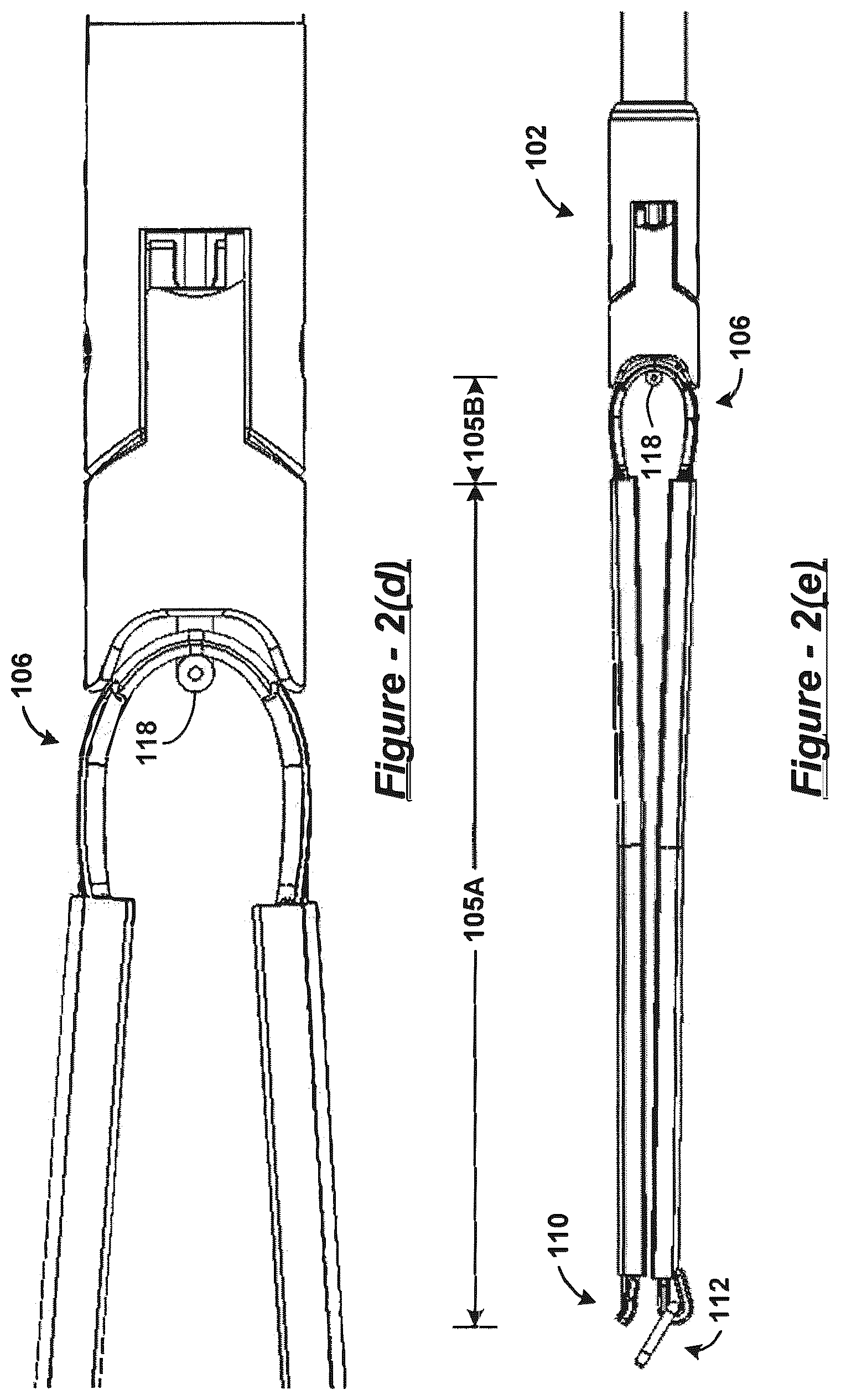 Patent US12318093 Figure 3 – Polymer overmolded bariatric clamp and method of installing