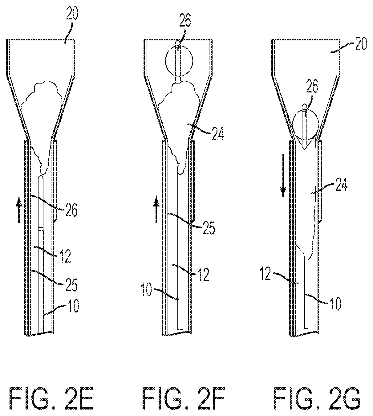 Patent US12318097 Figure 4 – Systems and methods for removing undesirable material within a circulatory system