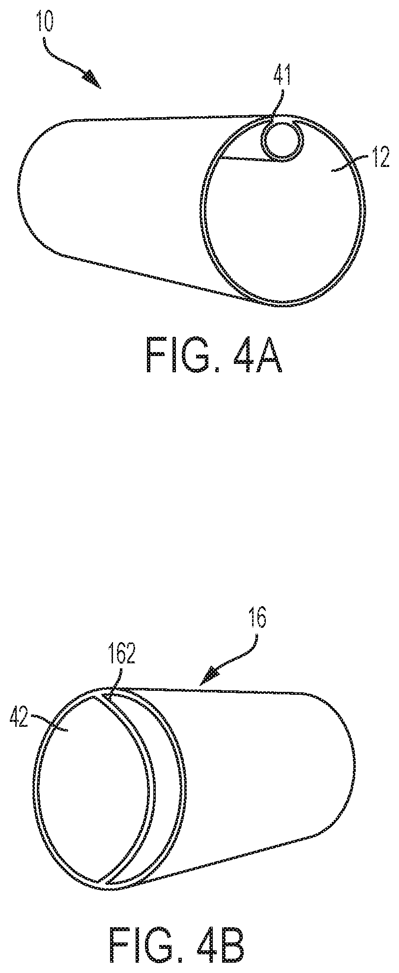 Patent US12318097 Figure 7 – Systems and methods for removing undesirable material within a circulatory system