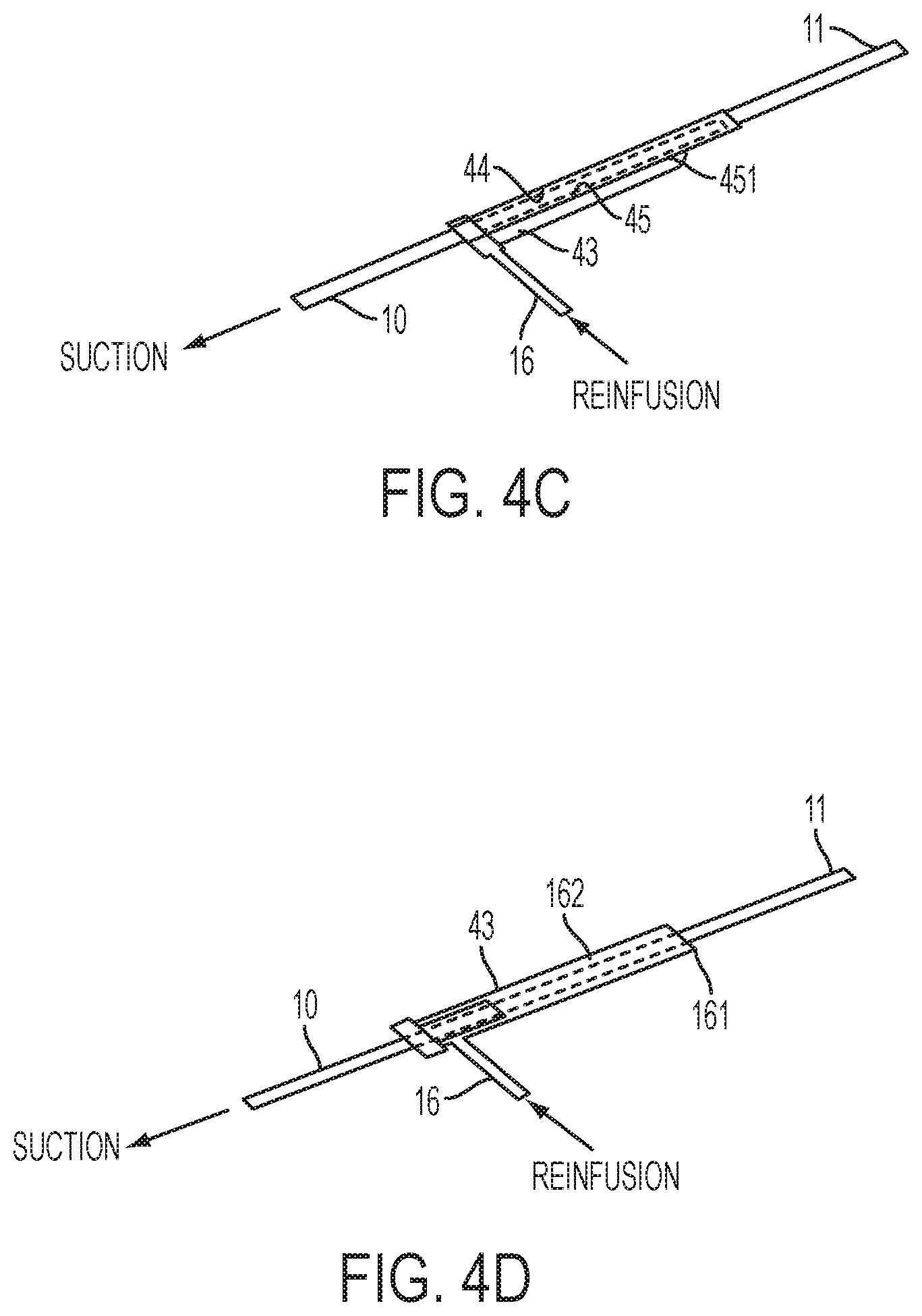 Patent US12318097 Figure 8 – Systems and methods for removing undesirable material within a circulatory system