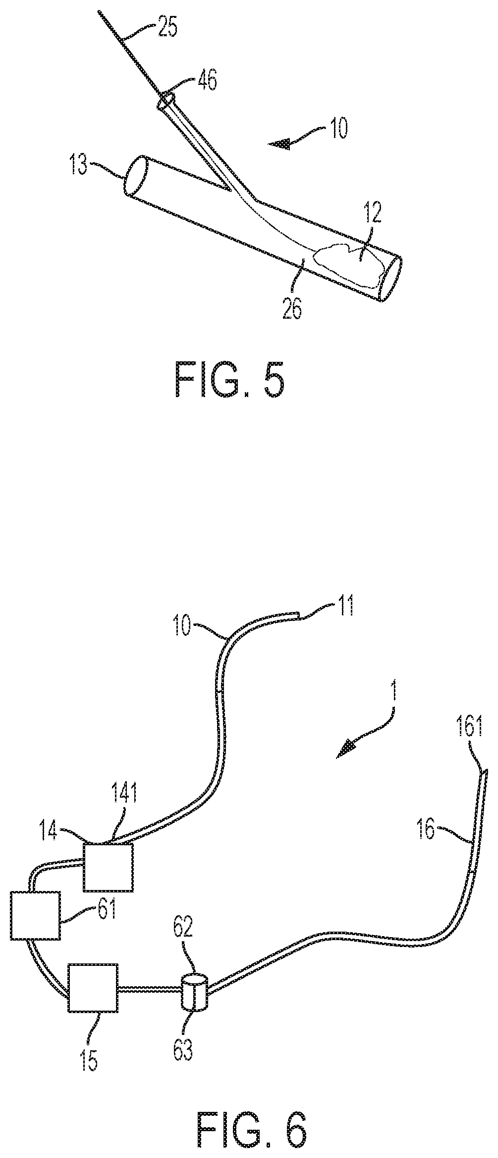Patent US12318097 Figure 10 – Systems and methods for removing undesirable material within a circulatory system