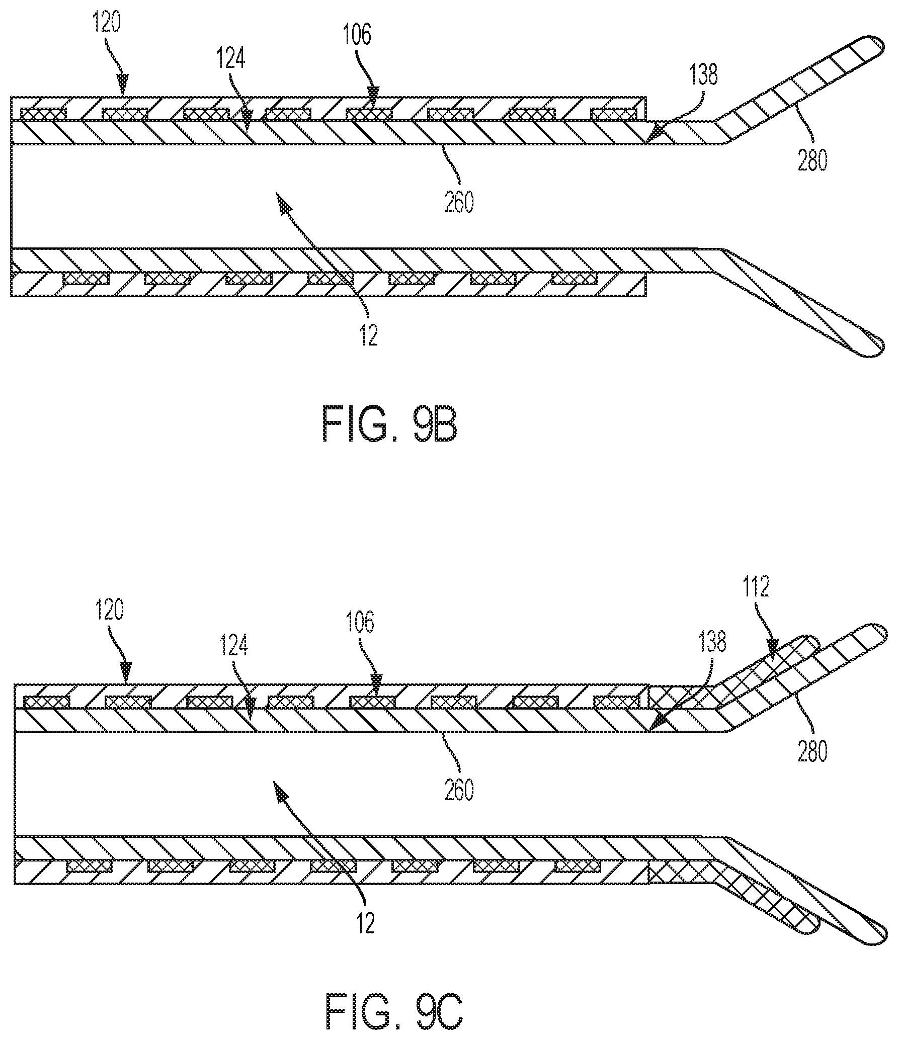 Patent US12318097 Figure 14 – Systems and methods for removing undesirable material within a circulatory system