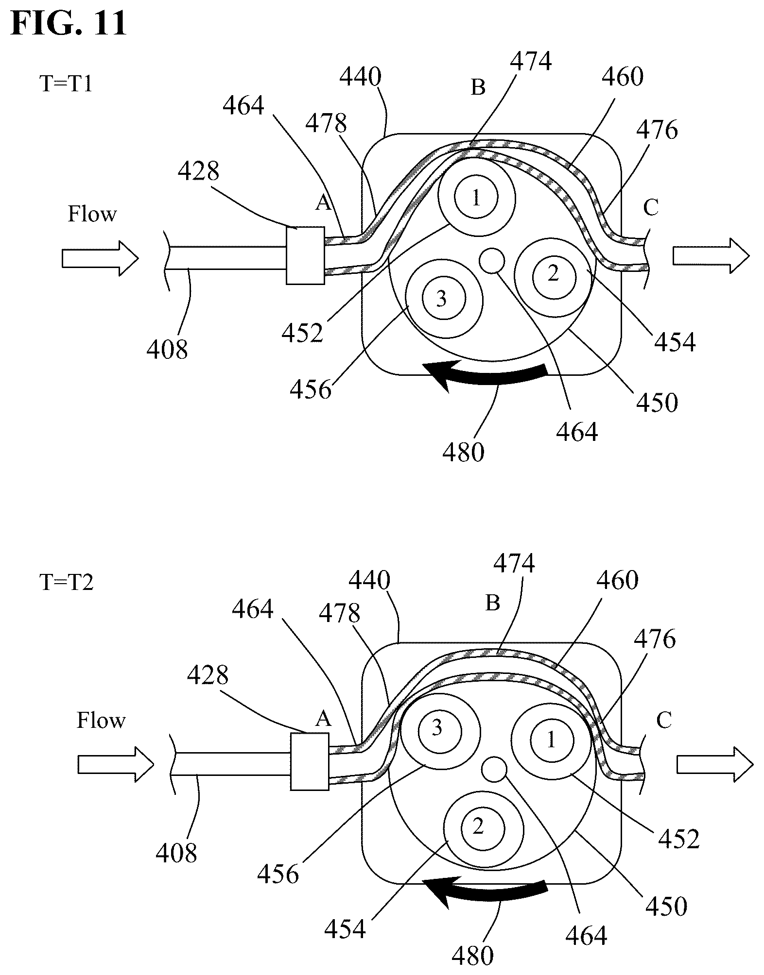 Patent US12318098 Figure 9 – Aspiration systems, devices and methods for treating ischemic stroke