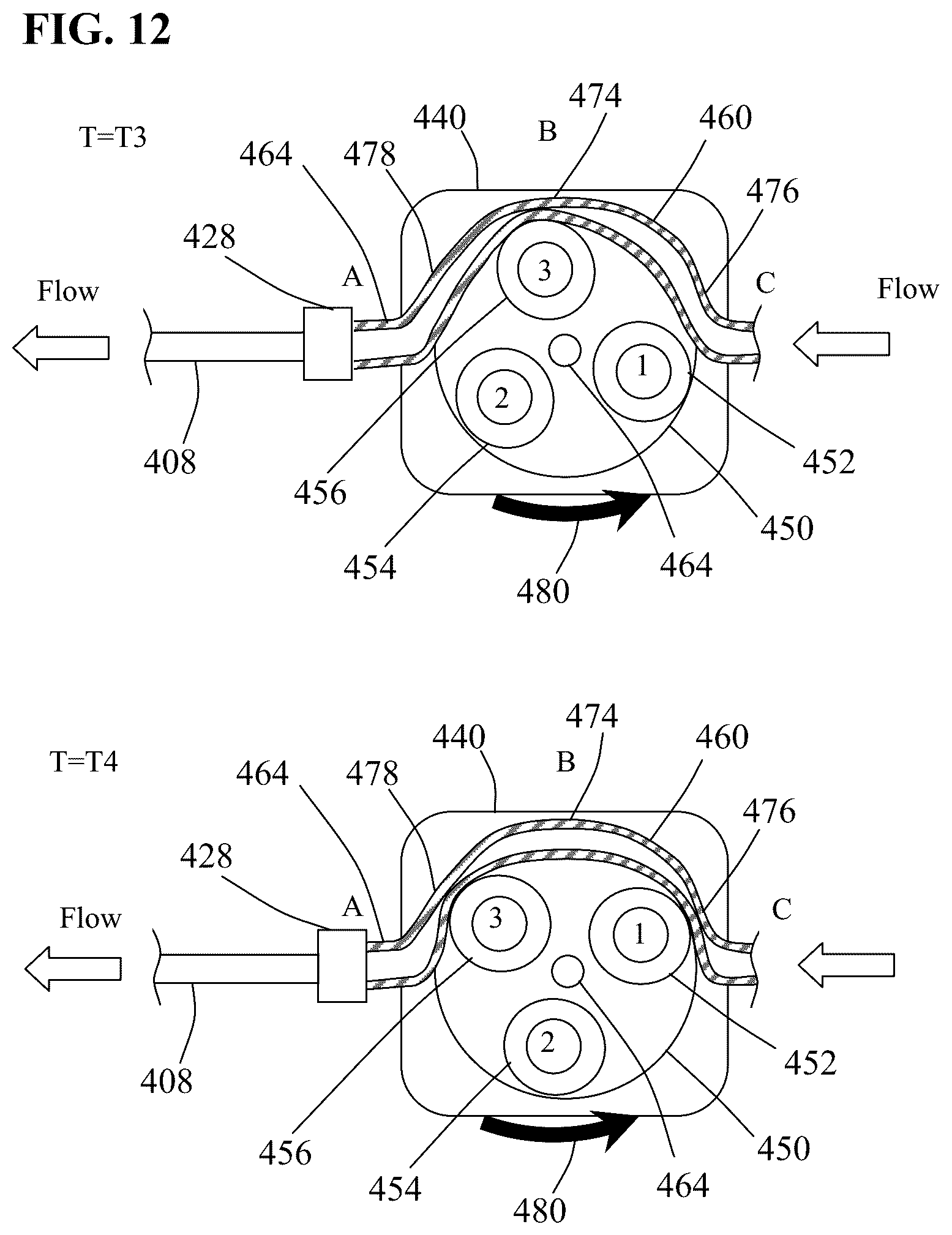 Patent US12318098 Figure 10 – Aspiration systems, devices and methods for treating ischemic stroke