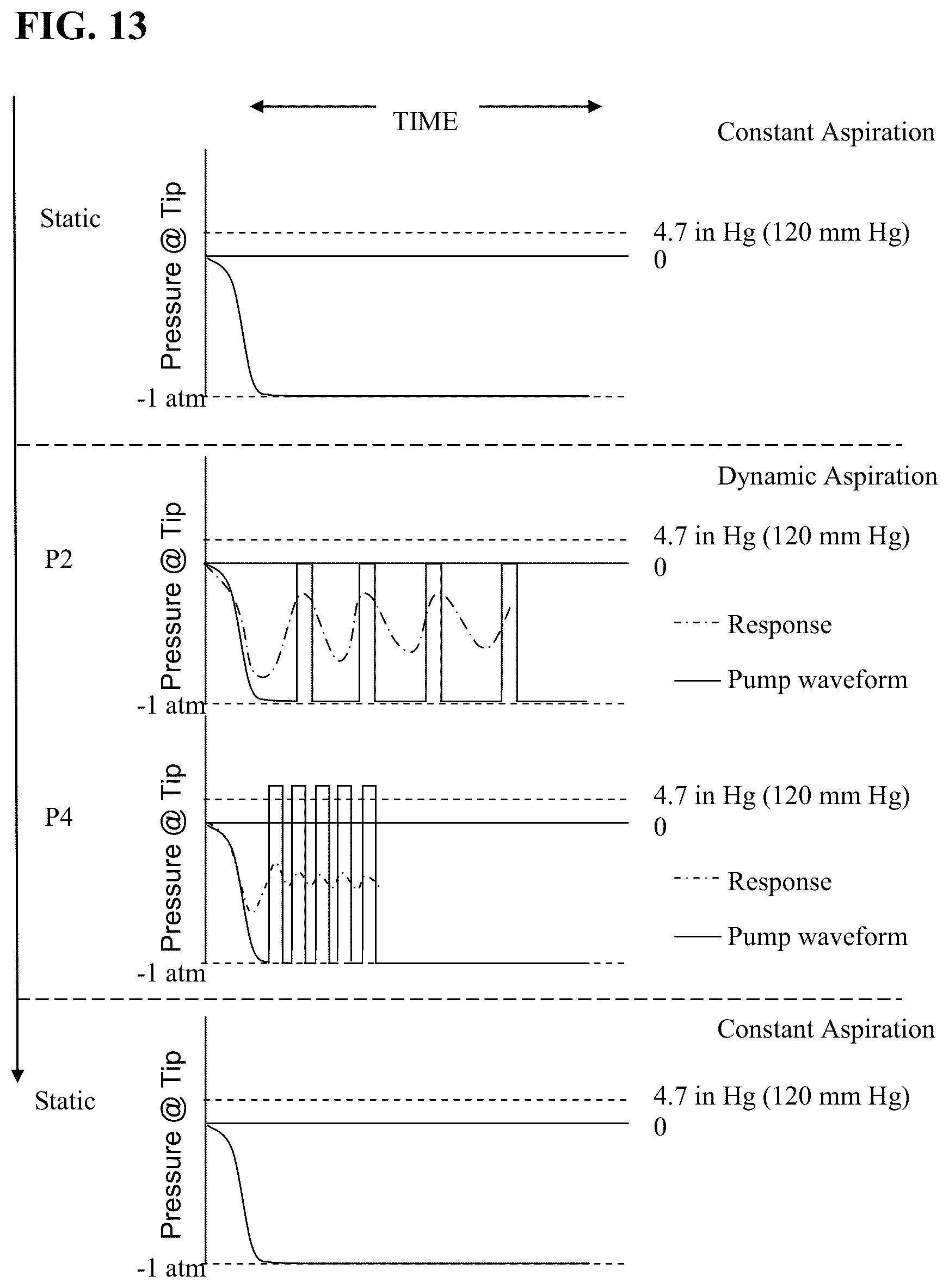 Patent US12318098 Figure 11 – Aspiration systems, devices and methods for treating ischemic stroke